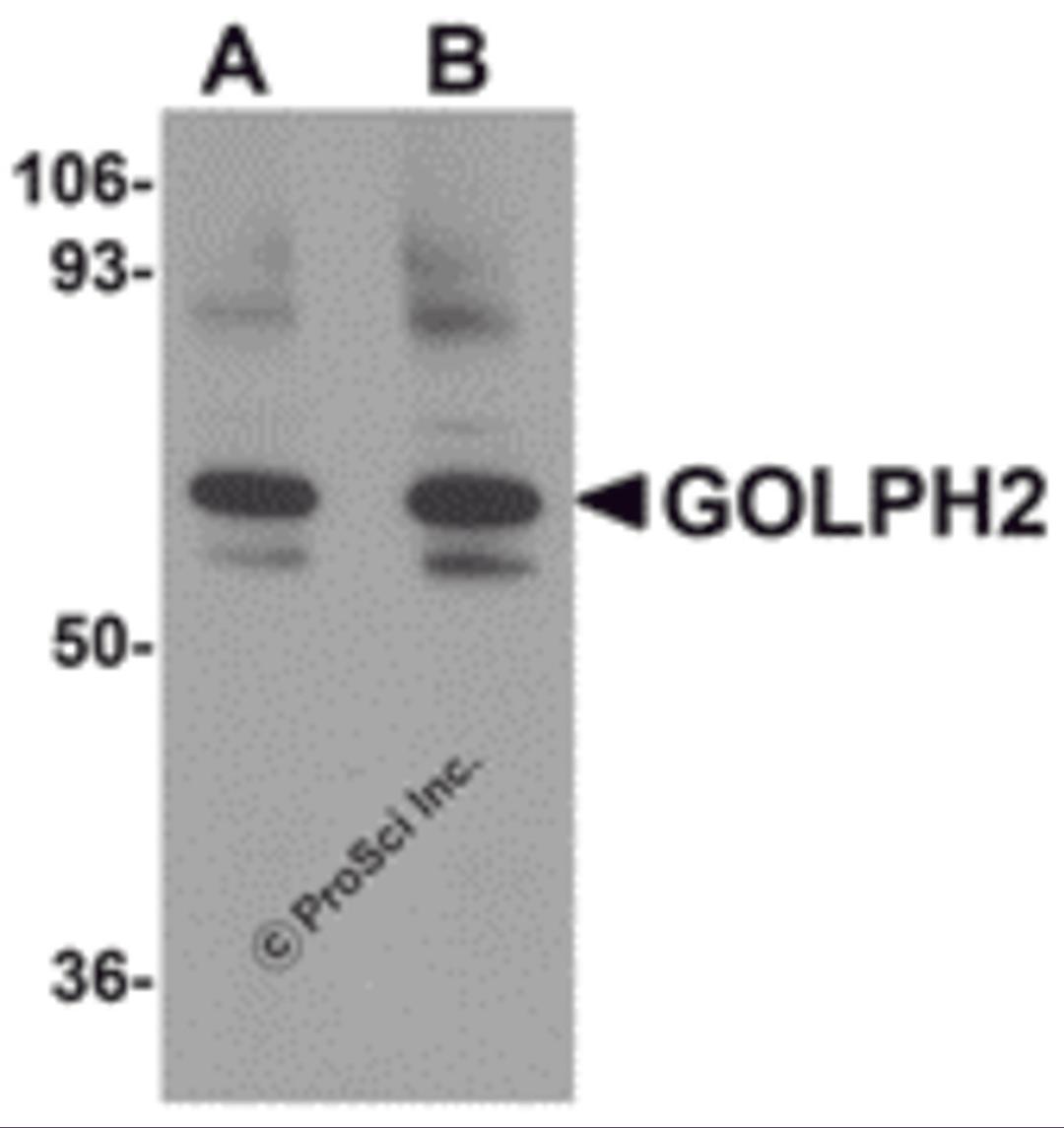 Western blot analysis of GOLPH2 in rat brain tissue lysate with GOLPH2 antibody at (A) 0.25 and (B) 0.5 μg/mL.