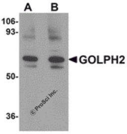 Western blot analysis of GOLPH2 in rat brain tissue lysate with GOLPH2 antibody at (A) 0.25 and (B) 0.5 μg/mL.