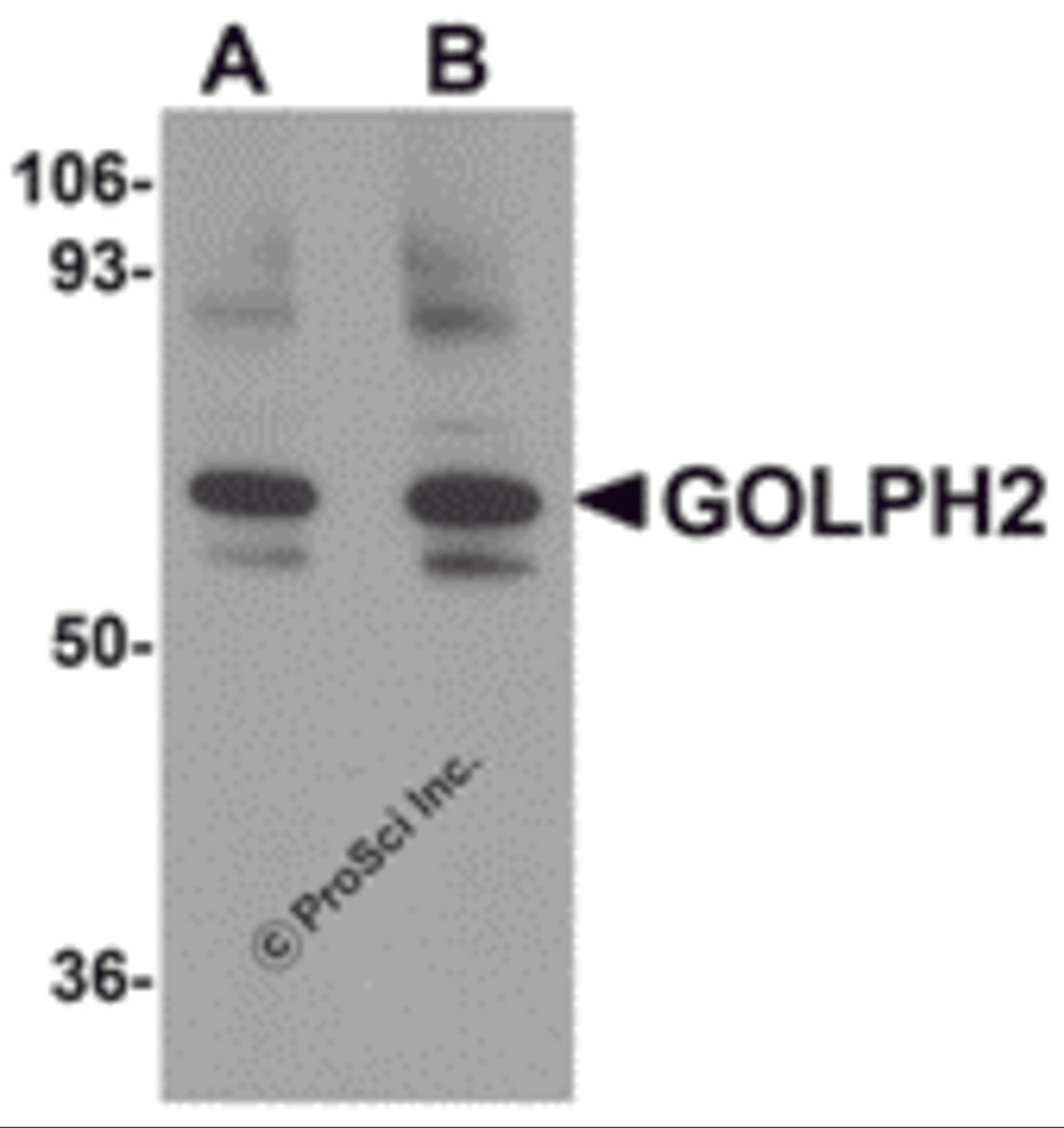 Western blot analysis of GOLPH2 in rat brain tissue lysate with GOLPH2 antibody at (A) 0.25 and (B) 0.5 μg/mL.