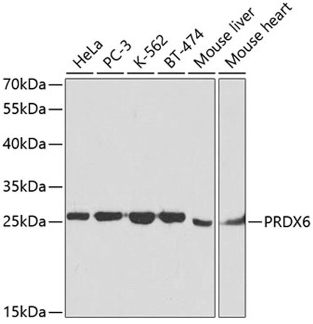 Western blot - PRDX6 antibody (A2031)