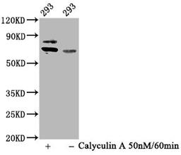 Western Blot. Positive WB detected in 293 whole cell lysate(treated with Calyculin A or not). All lanes Phospho-RPS6KB1 antibody at 0.93μg/ml. Secondary. Goat polyclonal to rabbit IgG at 1/50000 dilution. Predicted band size: 70 KDa. Observed band size: 70 KDa.
