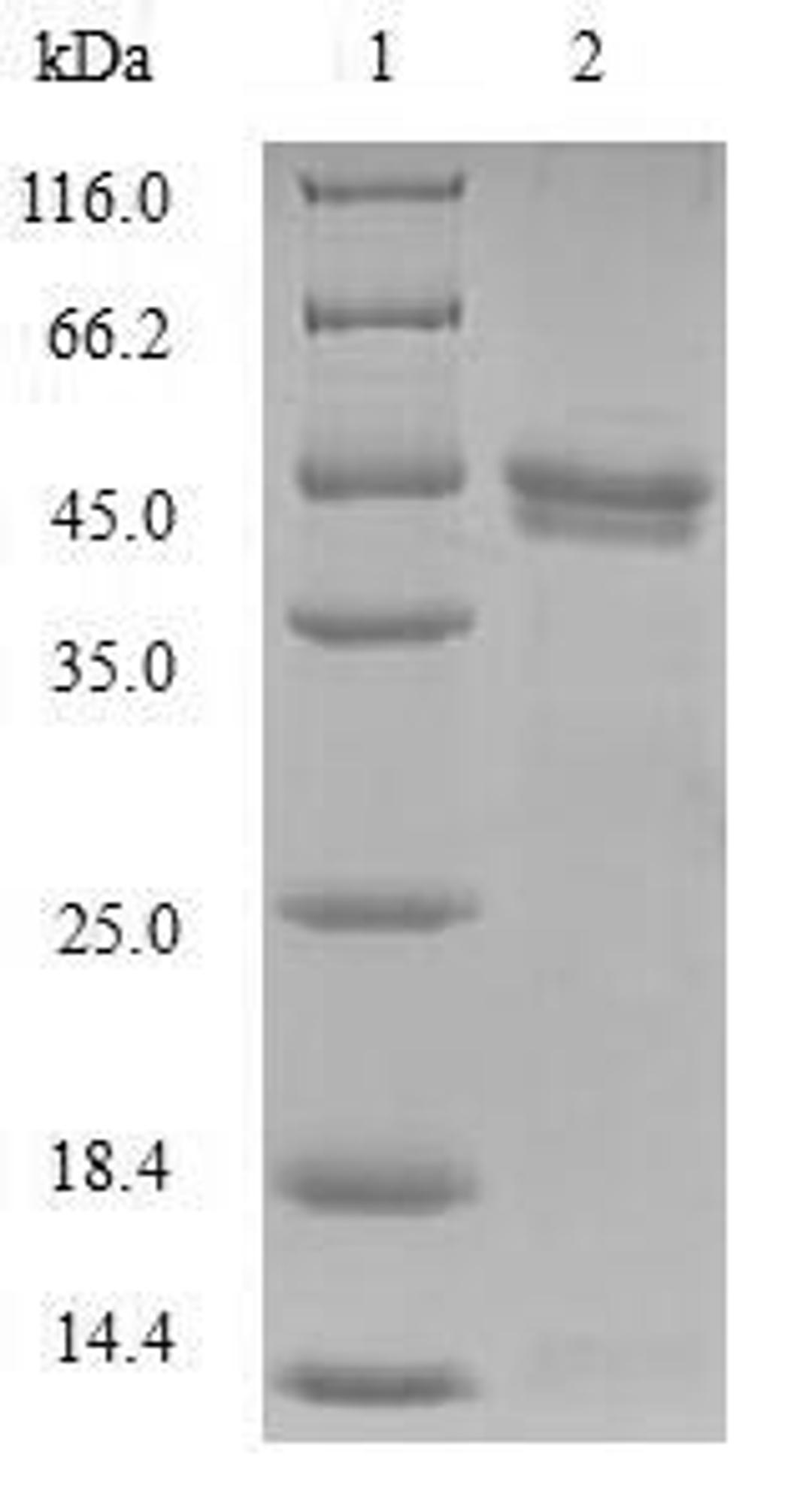 (Tris-Glycine gel) Discontinuous SDS-PAGE (reduced) with 5% enrichment gel and 15% separation gel.