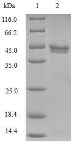 (Tris-Glycine gel) Discontinuous SDS-PAGE (reduced) with 5% enrichment gel and 15% separation gel.