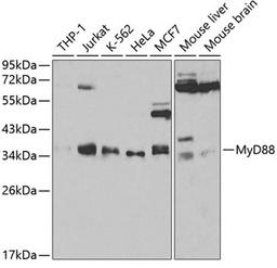 Western blot - MyD88 antibody (A0980)