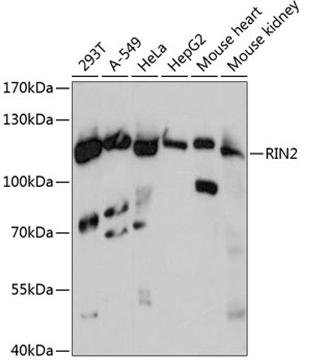 Western blot - RIN2 antibody (A13798)