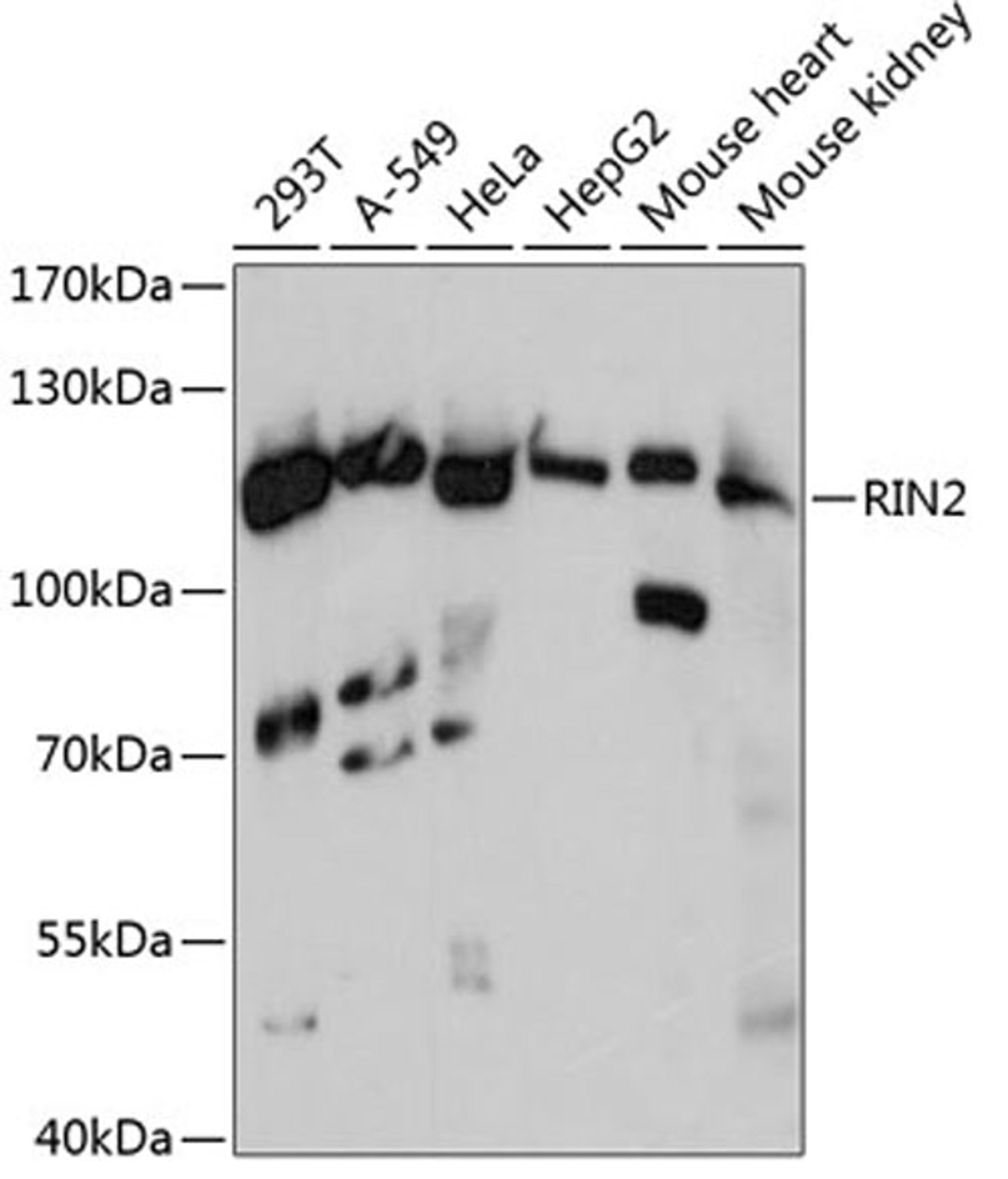 Western blot - RIN2 antibody (A13798)