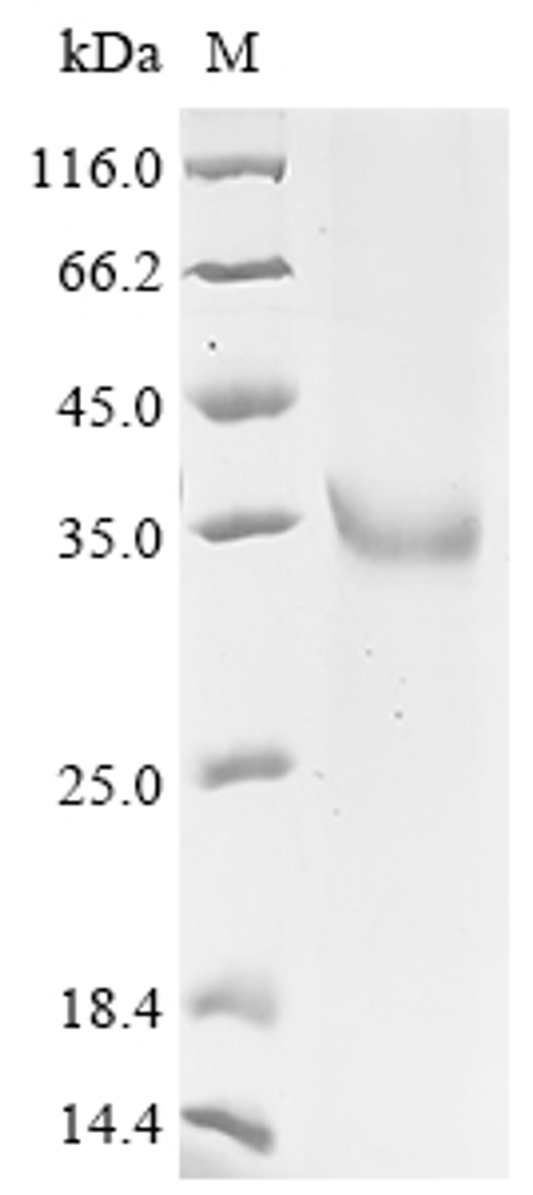 (Tris-Glycine gel) Discontinuous SDS-PAGE (reduced) with 5% enrichment gel and 15% separation gel.