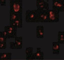 Immunocytochemistry/Immunofluorescence: Fibulin-3/EFEMP1 Antibody [NBP1-77040] - Immunofluorescence of Fibulin 3 in HeLa cells with Fibulin 3 antibody at 20 ug/mL.