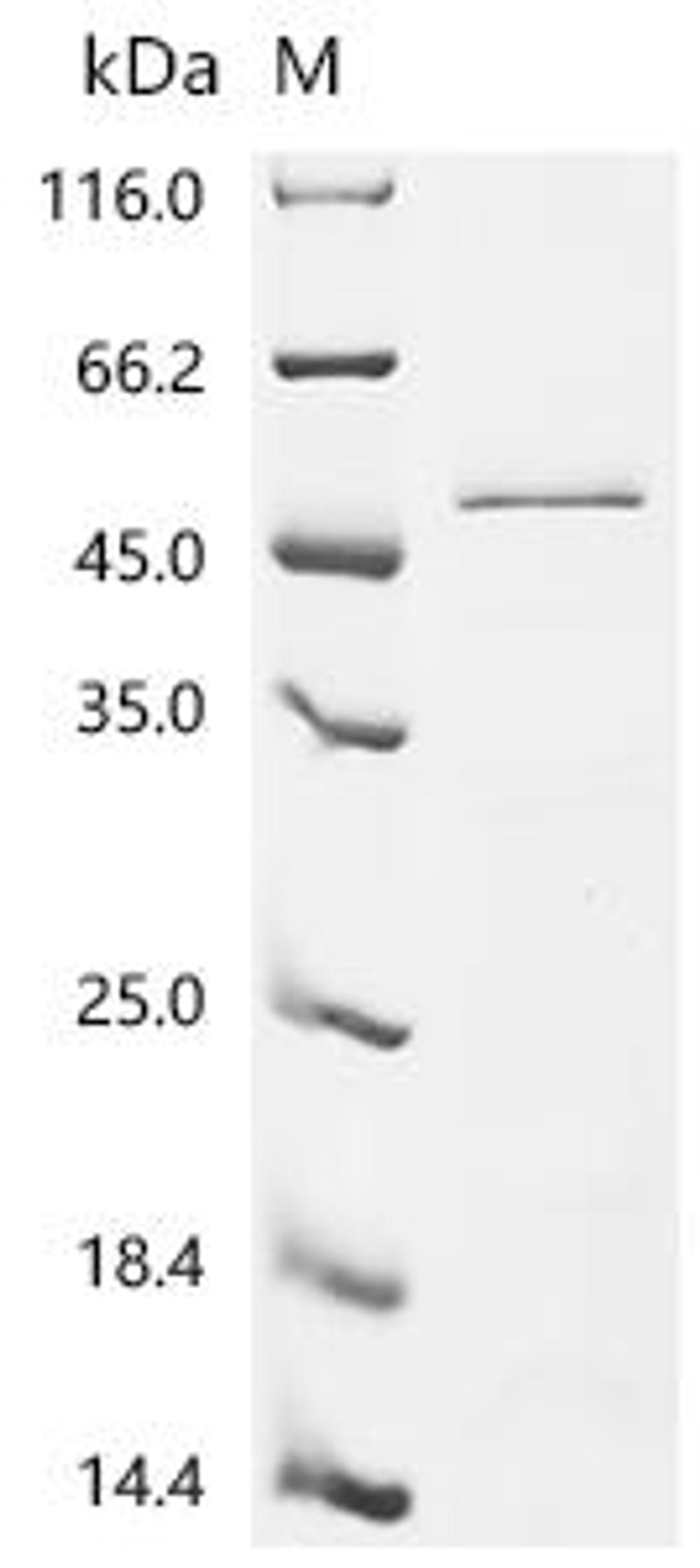 (Tris-Glycine gel) Discontinuous SDS-PAGE (reduced) with 5% enrichment gel and 15% separation gel.