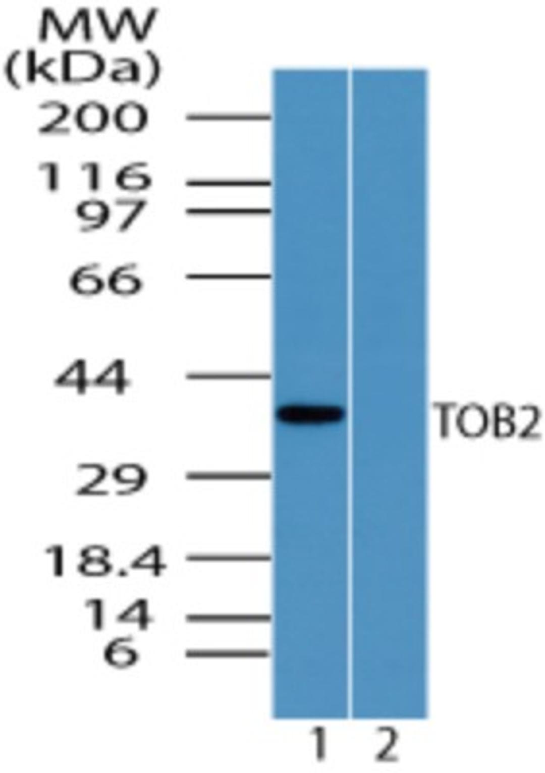 Western Blot: TOB2 Antibody [NBP2-24619] - Analysis of TOB2 in human heart lysate in the 1) absence and 2) presence of immunizing peptide using this antibody at 5 ug/ml.