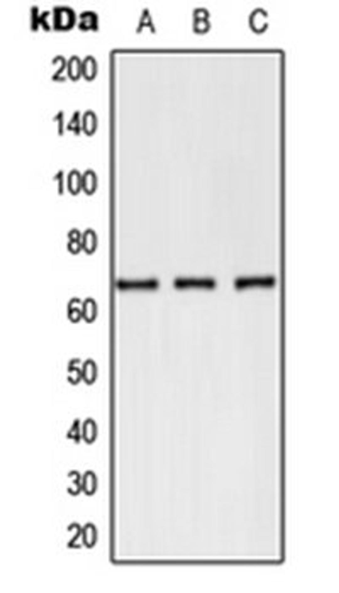 Western blot analysis of PC12 (Lane 1), NIH3T3 (Lane 2), Jurkat (Lane 3) whole cell lysates using SELE antibody