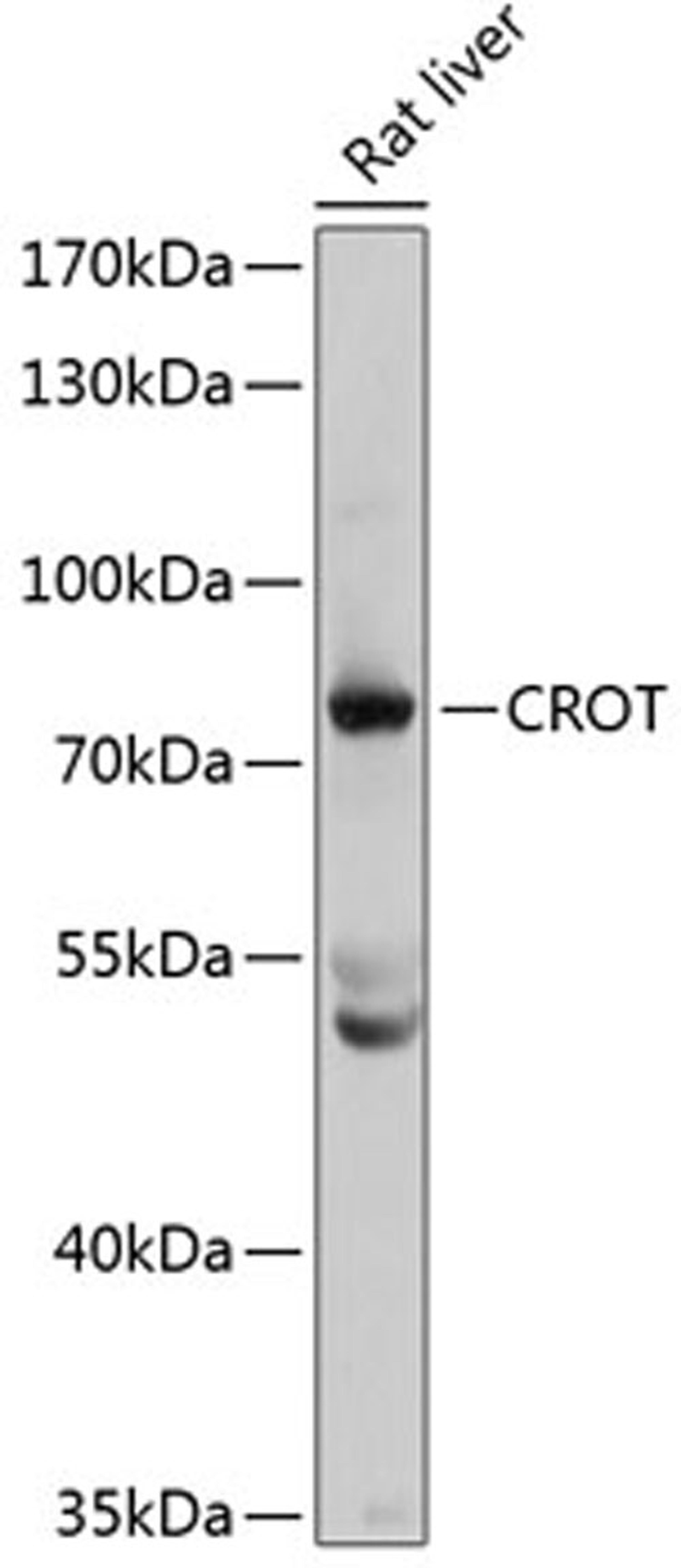 Western blot - CROT antibody (A4790)