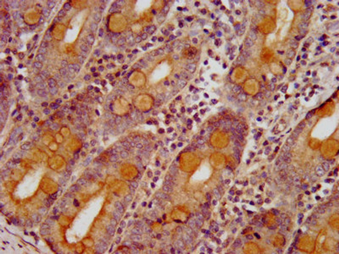 IHC image of CSB-PA861164LA01HU diluted at 1:400 and staining in paraffin-embedded human small intestine tissue performed on a Leica BondTM system. After dewaxing and hydration, antigen retrieval was mediated by high pressure in a citrate buffer (pH 6.0). Section was blocked with 10% normal goat serum 30min at RT. Then primary antibody (1% BSA) was incubated at 4°C overnight. The primary is detected by a biotinylated secondary antibody and visualized using an HRP conjugated SP system.