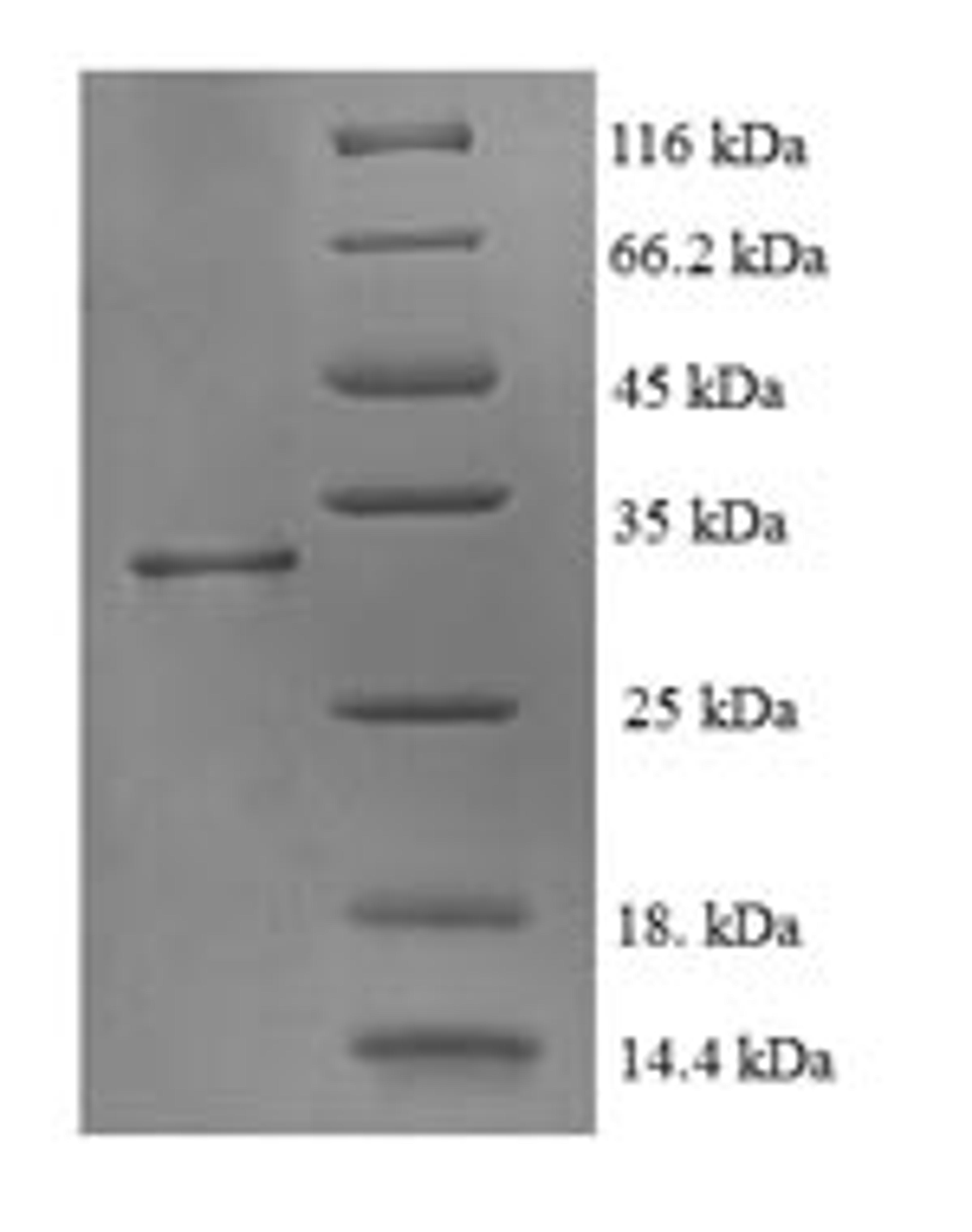 (Tris-Glycine gel) Discontinuous SDS-PAGE (reduced) with 5% enrichment gel and 15% separation gel.