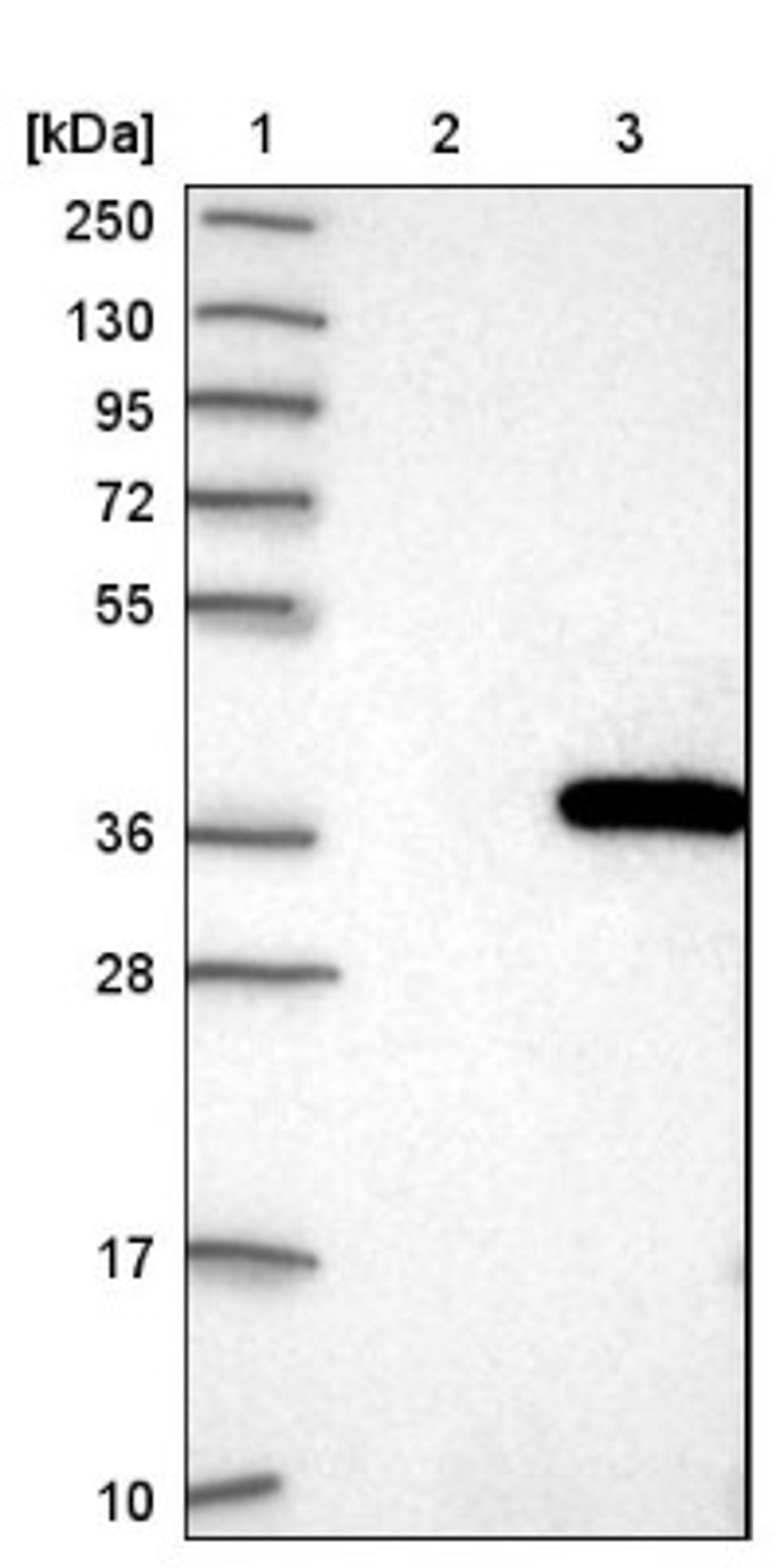 Western Blot: HUS1 Antibody [NBP1-89445] - Lane 1: Marker [kDa] 250, 130, 95, 72, 55, 36, 28, 17, 10<br/>Lane 2: Negative control (vector only transfected HEK293T lysate)<br/>Lane 3: Over-expression lysate (Co-expressed with a C-terminal myc-DDK tag (~3.1 kDa) in mammalian HEK293T cells, LY401435)