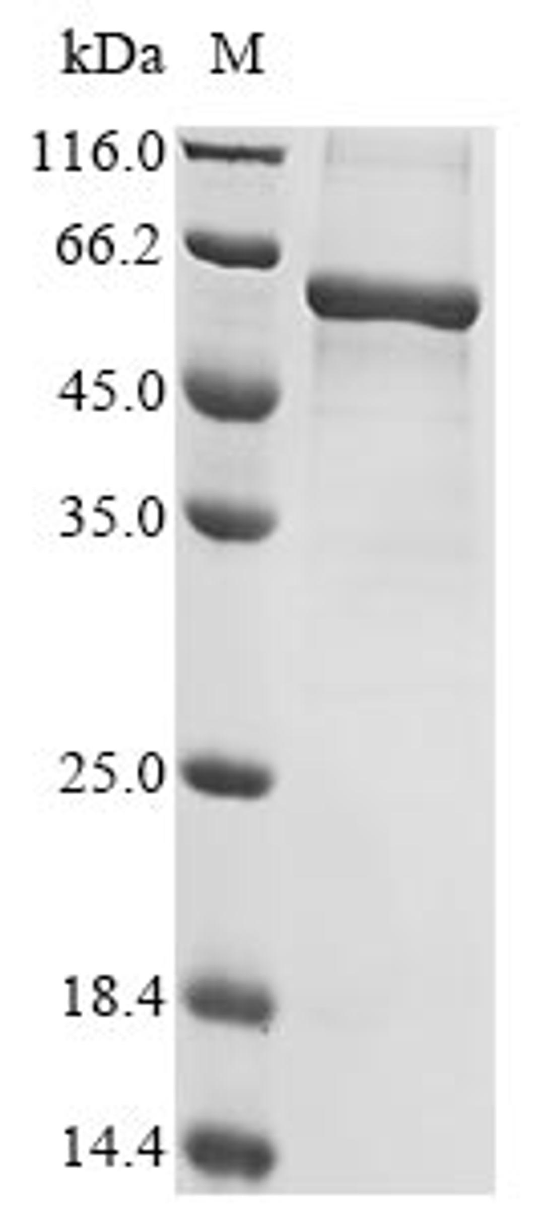(Tris-Glycine gel) Discontinuous SDS-PAGE (reduced) with 5% enrichment gel and 15% separation gel.