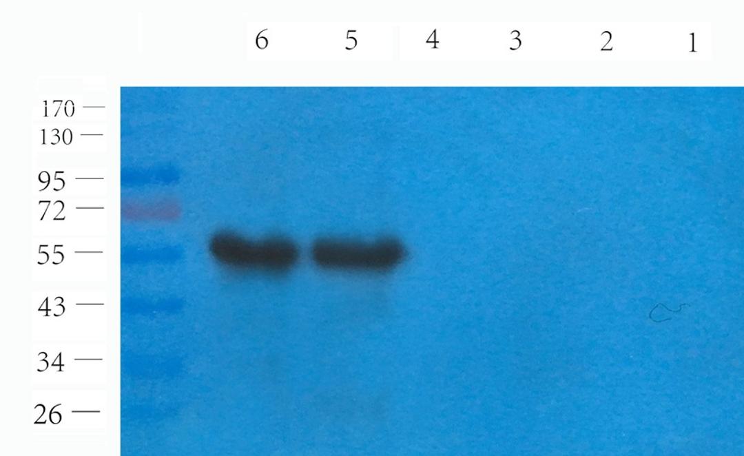 Western blot analysis of mouse testis (lane 1), rat skin (lane 2), mouse spleen (lane 3), mouse colon (lane 4), human lung cancer (lane 5), human breast cancer (lane 6) using SOX9 antibody (1 ug/ml)