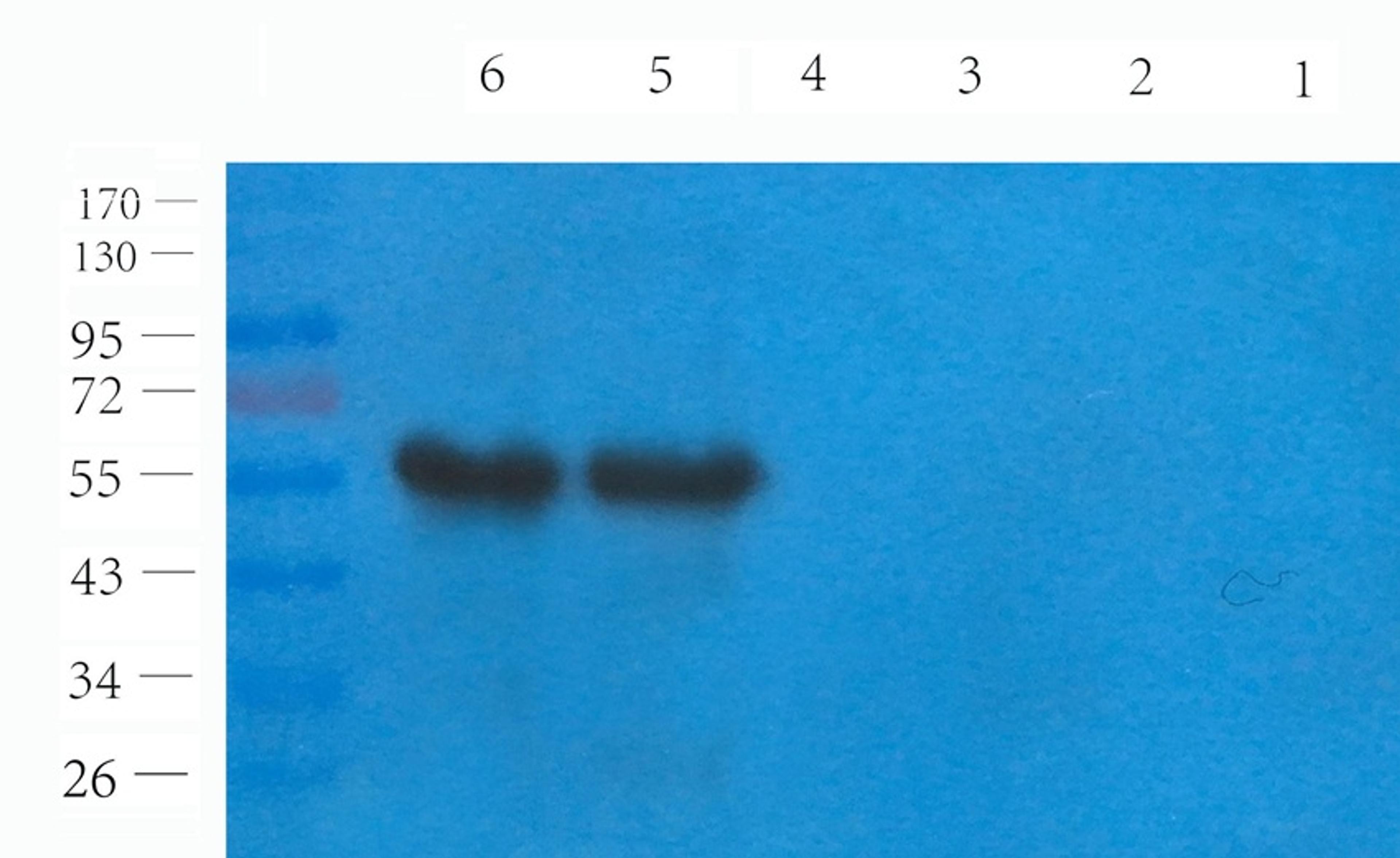 Western blot analysis of mouse testis (lane 1), rat skin (lane 2), mouse spleen (lane 3), mouse colon (lane 4), human lung cancer (lane 5), human breast cancer (lane 6) using SOX9 antibody (1 ug/ml)