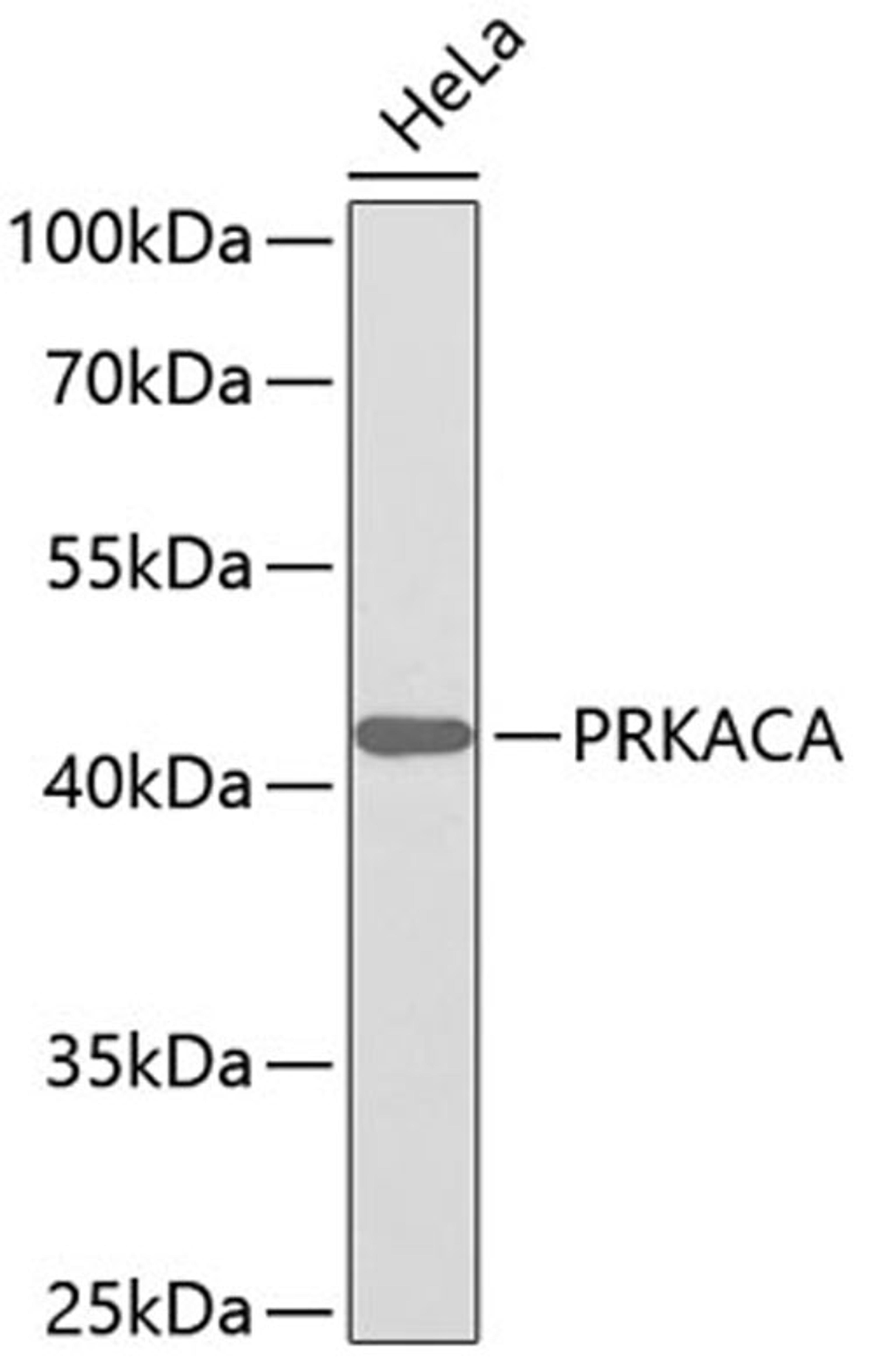 Western blot - PRKACA antibody (A0798)