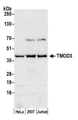 Detection of human TMOD3 by western blot.