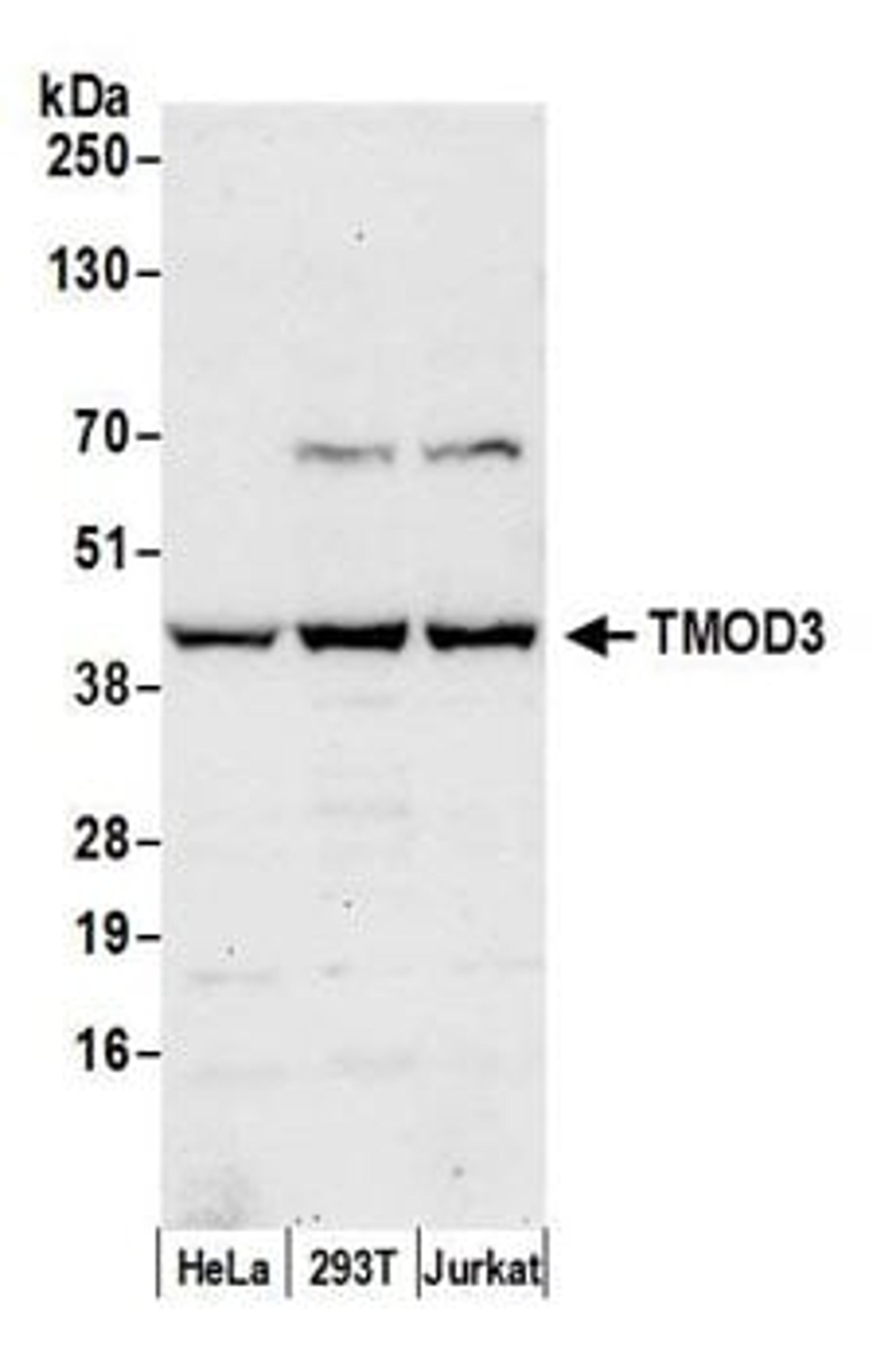 Detection of human TMOD3 by western blot.