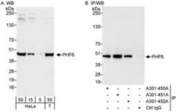 Detection of human PHF6 by western blot and immunoprecipitation.