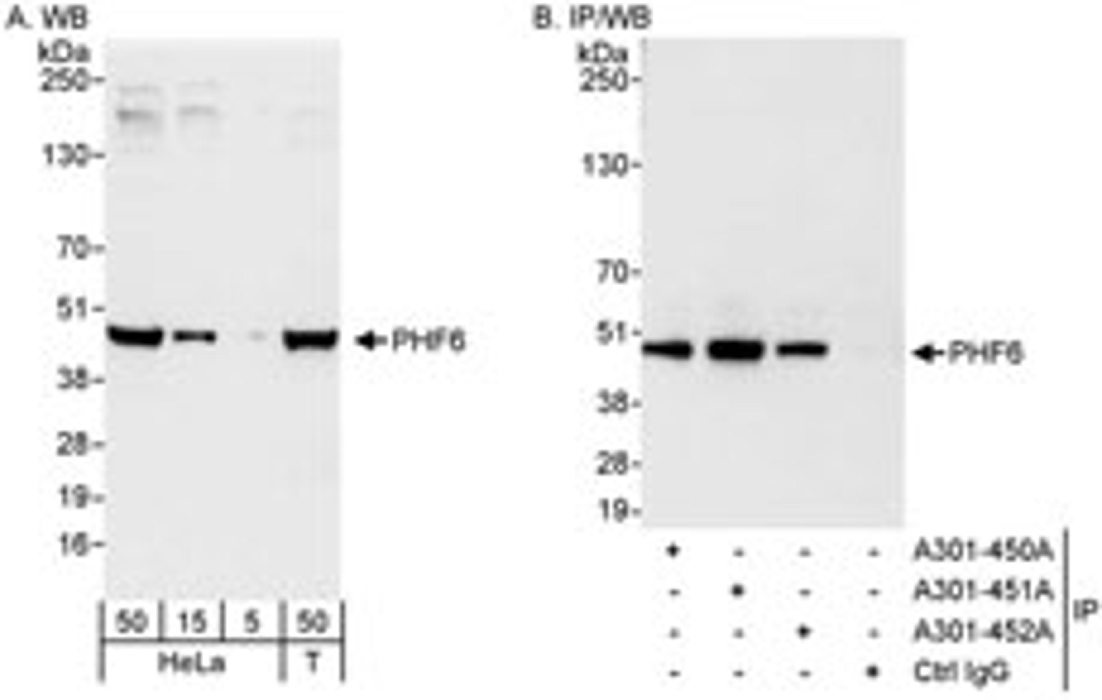 Detection of human PHF6 by western blot and immunoprecipitation.