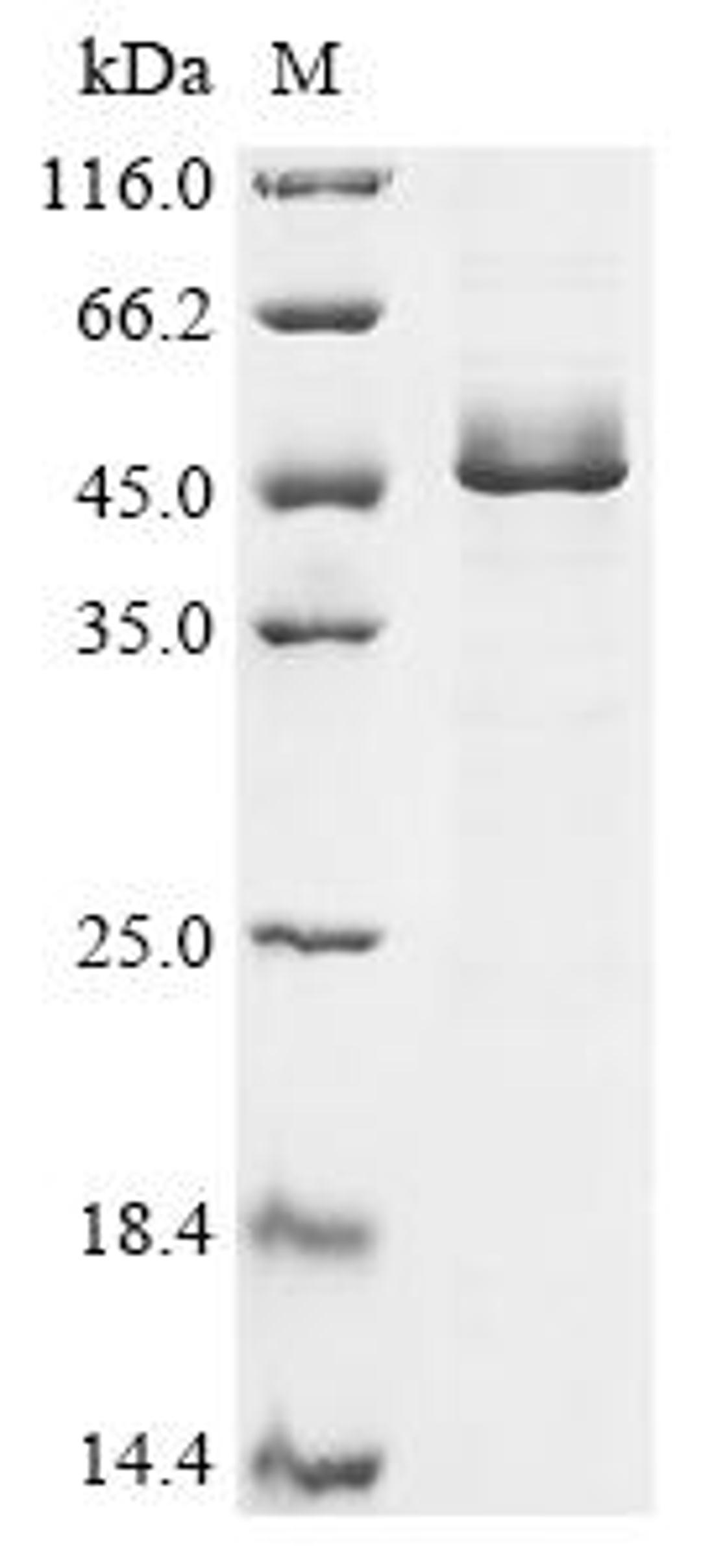 (Tris-Glycine gel) Discontinuous SDS-PAGE (reduced) with 5% enrichment gel and 15% separation gel.