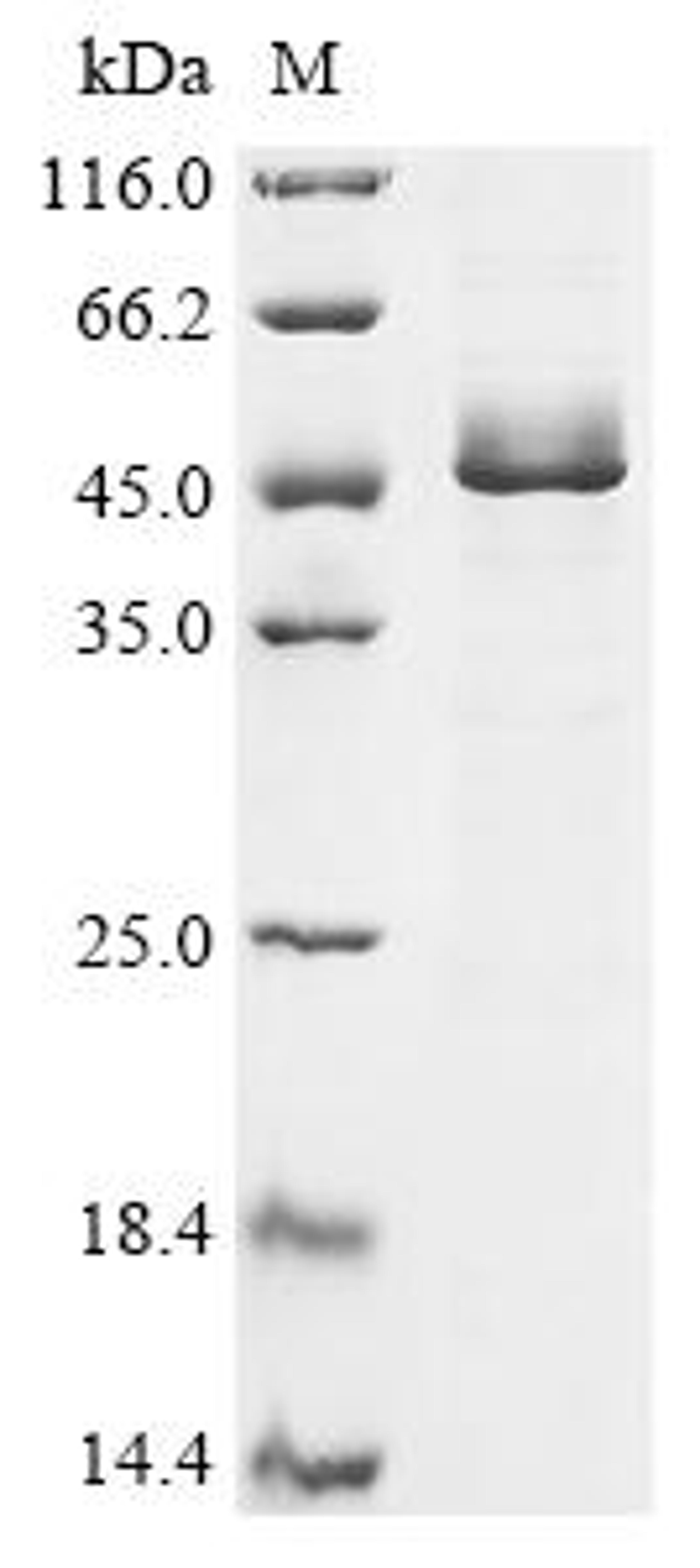 (Tris-Glycine gel) Discontinuous SDS-PAGE (reduced) with 5% enrichment gel and 15% separation gel.