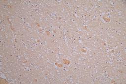 IHC image of CSB-RA614975MA1HU diluted at 1:150 and staining in paraffin-embedded human brain tissue performed on a Leica BondTM system. After dewaxing and hydration, antigen retrieval was mediated by high pressure in a citrate buffer (pH 6.0). Section was blocked with 10% normal goat serum 30min at RT. Then primary antibody (1% BSA) was incubated at 4°C overnight. The primary is detected by a Goat anti-Rabbit IgG labeled by HRP and visualized using 0.05% DAB.