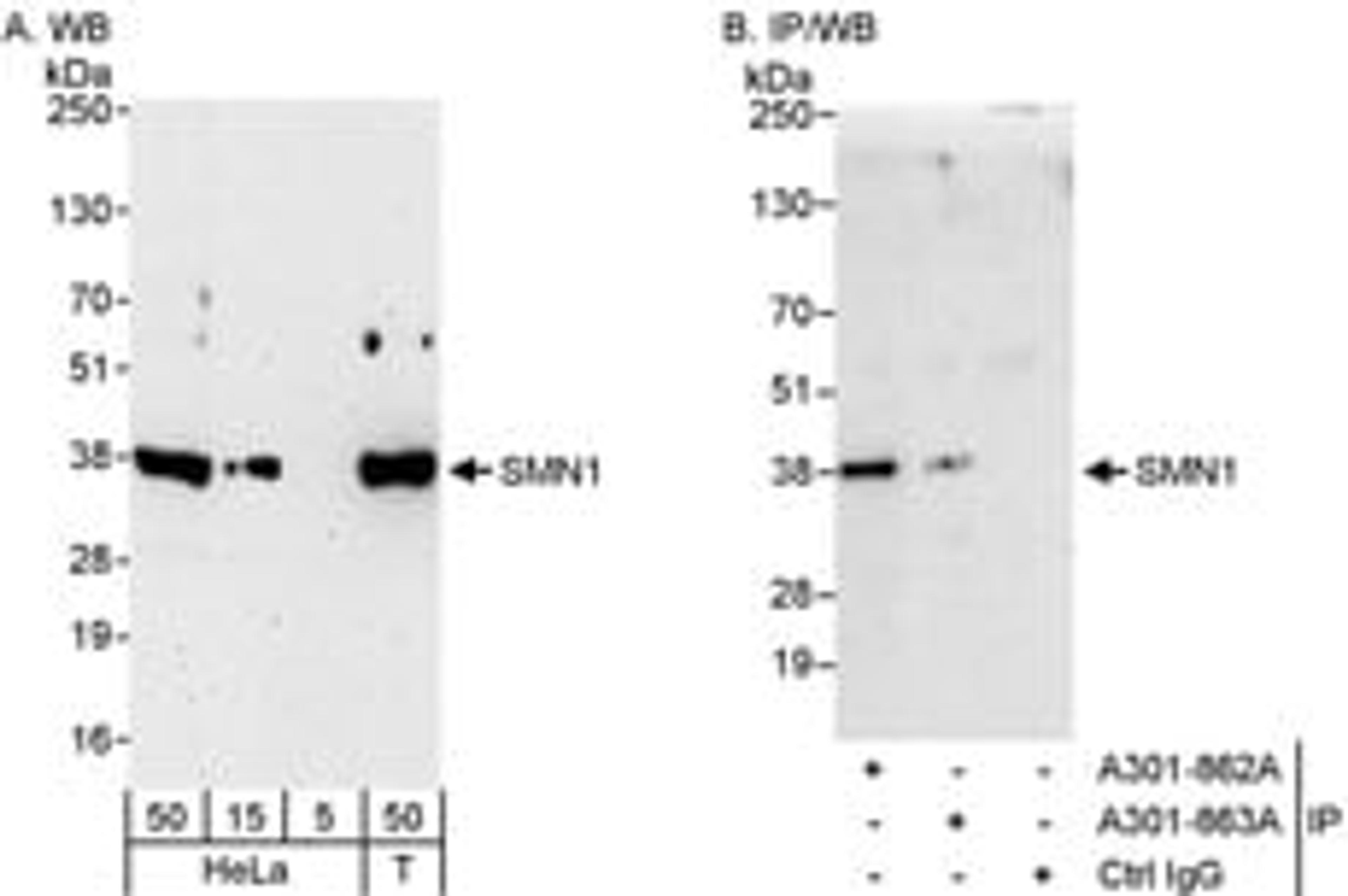 Detection of human SMN1 by western blot and immunoprecipitation.