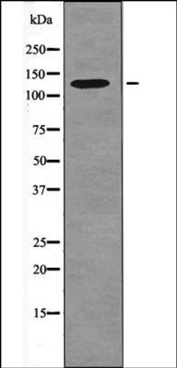 Western blot analysis of HeLa whole cell lysates using FAK -Phospho-Ser732- antibody