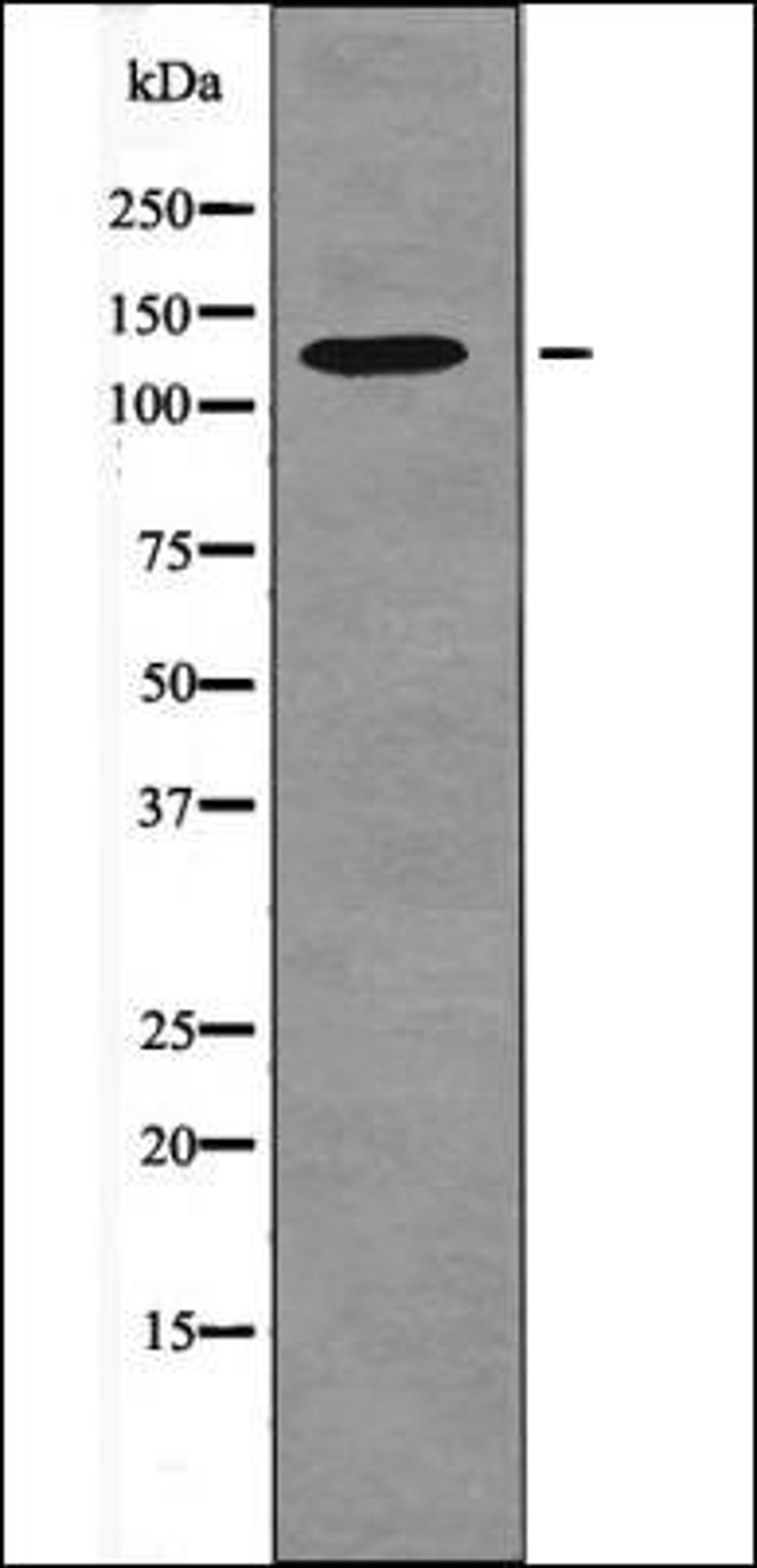 Western blot analysis of HeLa whole cell lysates using FAK -Phospho-Ser732- antibody