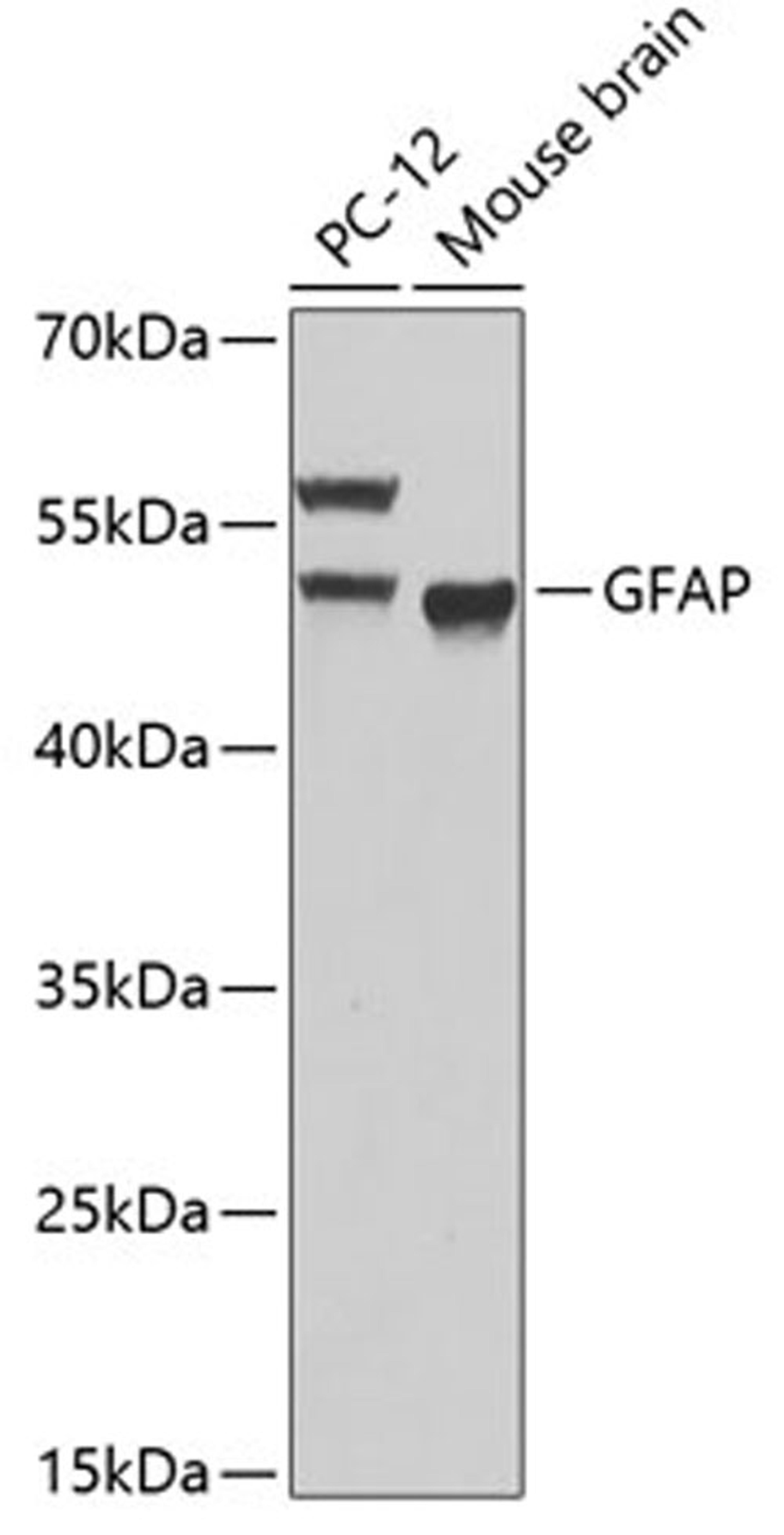 Western blot - GFAP antibody (A0237)