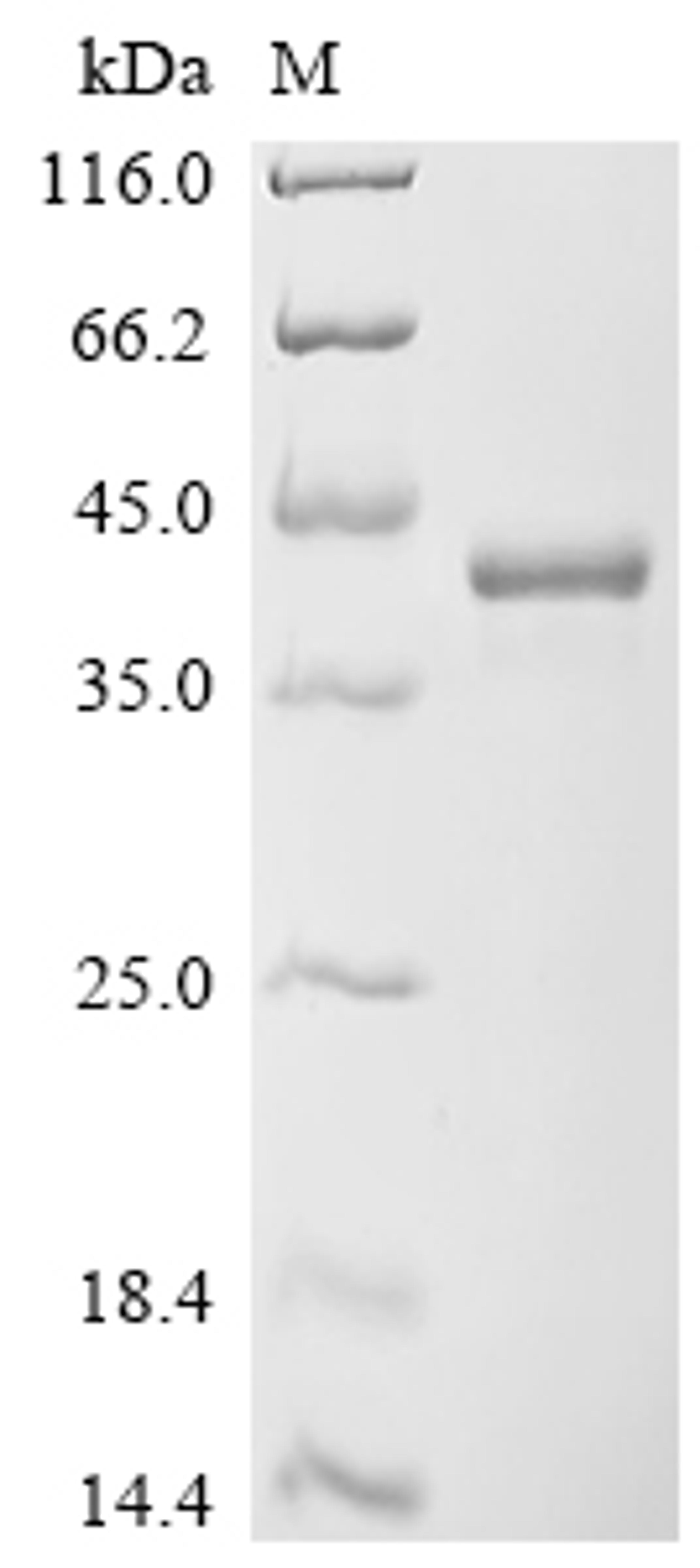 (Tris-Glycine gel) Discontinuous SDS-PAGE (reduced) with 5% enrichment gel and 15% separation gel.