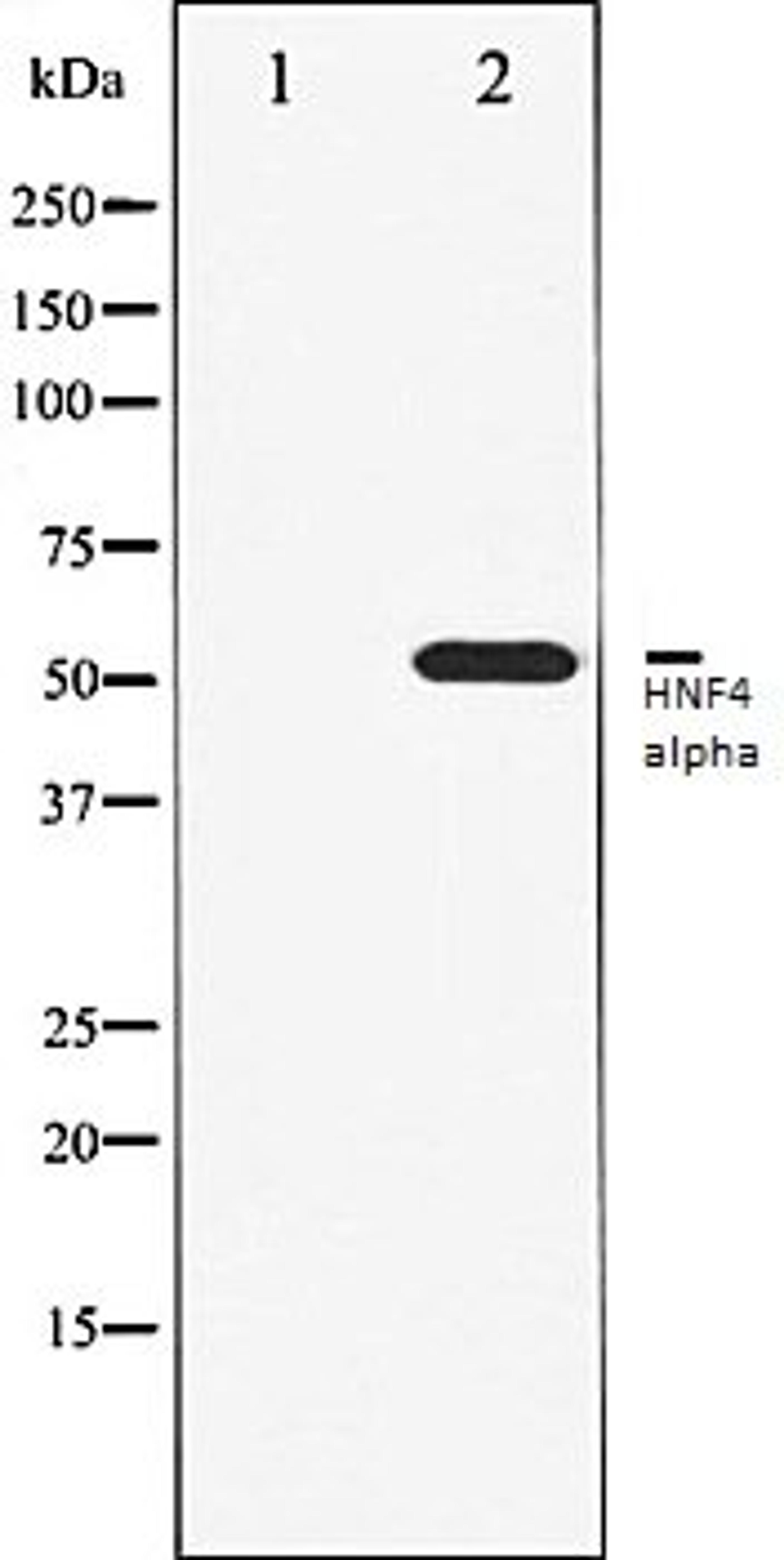 Western blot analysis of HT29 whole cell lysates using HNF4 alpha antibody, The lane on the left is treated with the antigen-specific peptide.