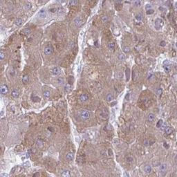 Immunohistochemistry: SC4MOL Antibody [NBP2-31624] - liver cancer