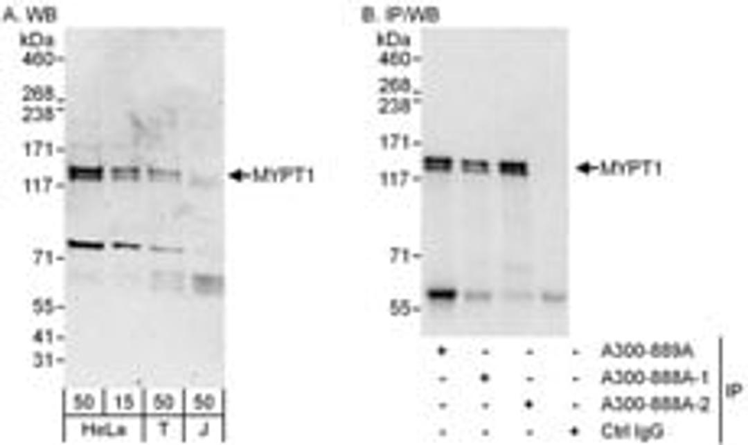 Detection of human MYPT1 by western blot and immunoprecipitation.