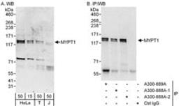 Detection of human MYPT1 by western blot and immunoprecipitation.