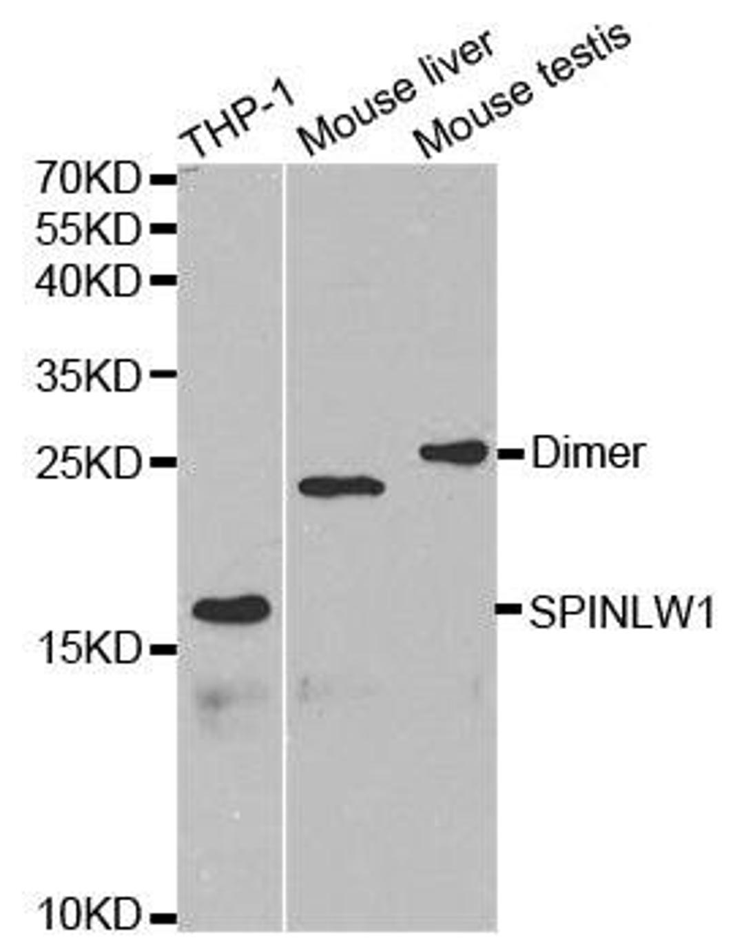 Western blot analysis of extracts of various cell lines using SPINLW1 antibody