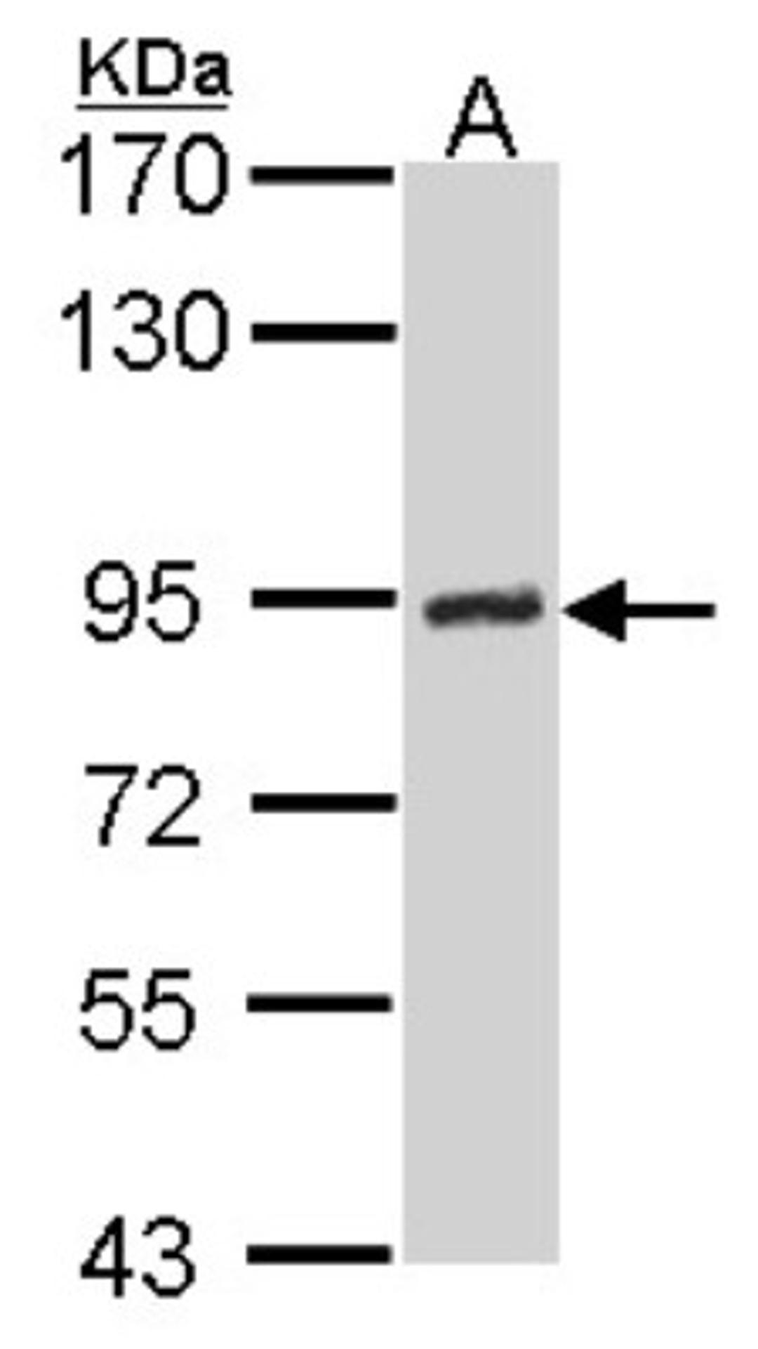 Western Blot: DNA Ligase III Antibody (1F3) [NBP1-41190] - Sample (30 ug of whole cell lysate) A: Hela 7. 5% SDS PAGE, antibody diluted at 1:500.