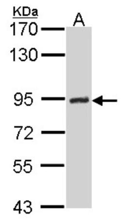 Western Blot: DNA Ligase III Antibody (1F3) [NBP1-41190] - Sample (30 ug of whole cell lysate) A: Hela 7. 5% SDS PAGE, antibody diluted at 1:500.