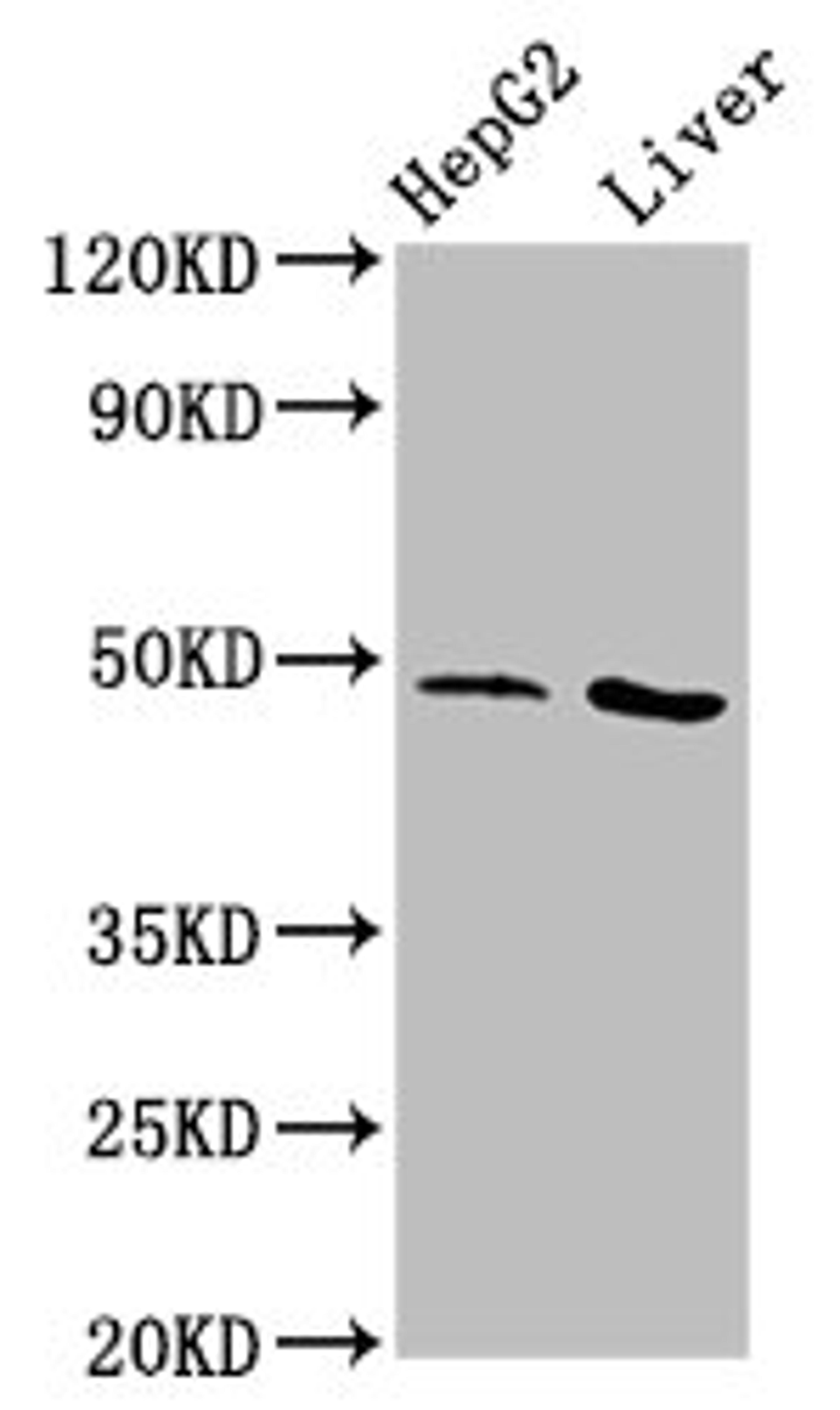 Western Blot. Positive WB detected in: HepG2 whole cell lysate, Rat liver tissue. All lanes: APMAP antibody at 3.1µg/ml. Secondary. Goat polyclonal to rabbit IgG at 1/50000 dilution. Predicted band size: 47, 33 kDa. Observed band size: 47 kDa