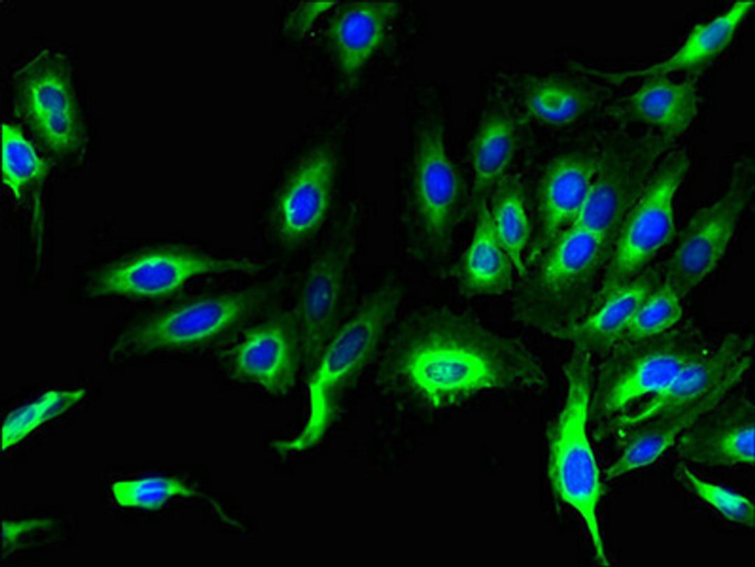 Immunofluorescent analysis of Hela cells using CSB-PA774822LA01HU at dilution of 1:100 and Alexa Fluor 488-congugated AffiniPure Goat Anti-Rabbit IgG(H+L)