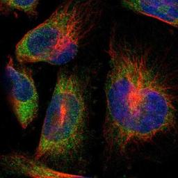 Immunocytochemistry/Immunofluorescence: PTPLAD1 Antibody [NBP1-88597] - Staining of human cell line U-251MG shows positivity in cytoplasm.