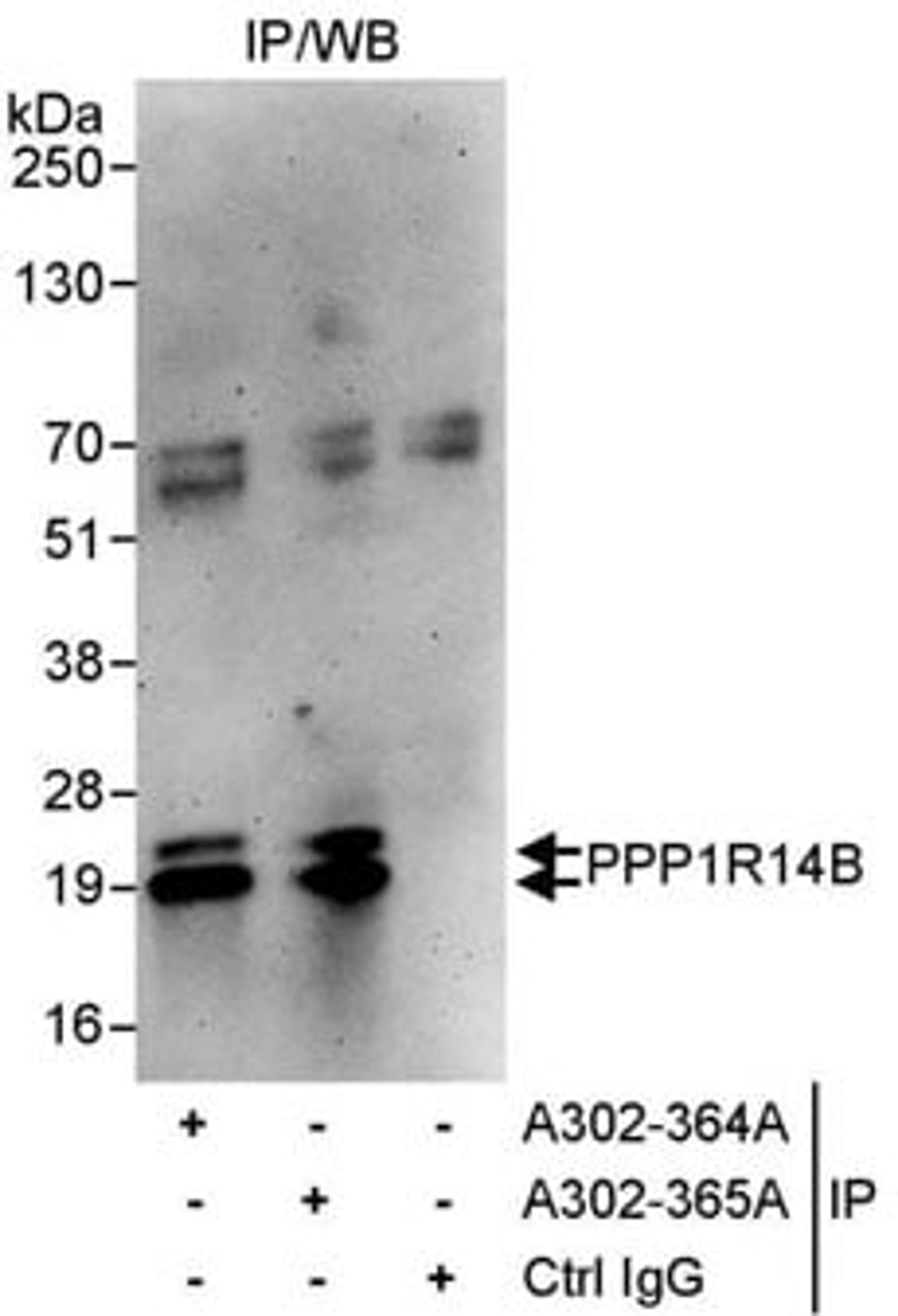 Detection of human PPP1R14B by western blot of immunoprecipitates.