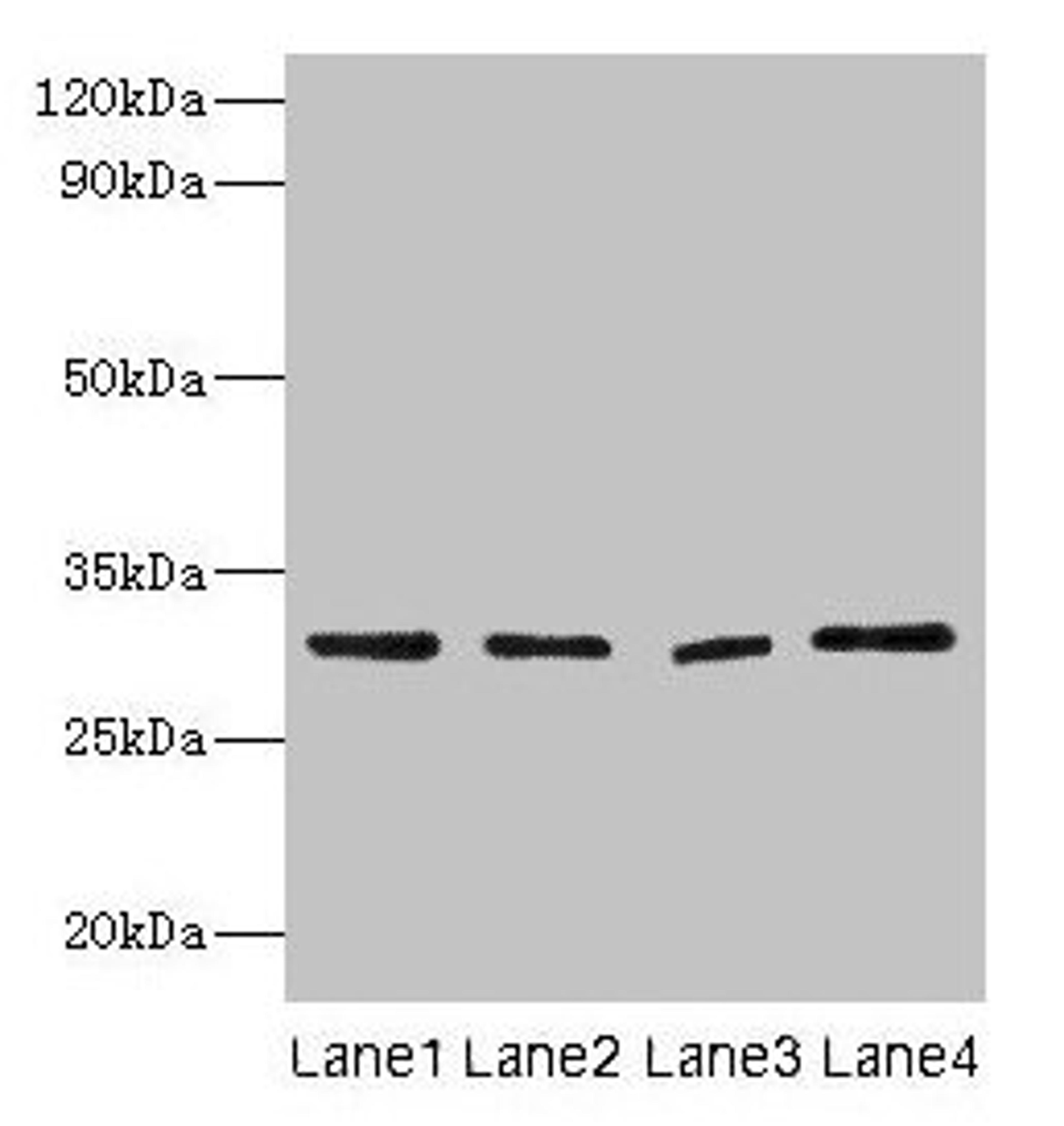 Western blot. All lanes: Mmp7 antibody at 2µg/ml. Lane 1: Colo320 whole cell lysaye. Lane 2: NIH/3T3 whole cell lysaye. Lane 3: Mouse lung tissue. Lane 4: HepG2 whole cell lysate. Secondary. Goat polyclonal to rabbit IgG at 1/10000 dilution. Predicted band size: 30 kDa. Observed band size: 30 kDa