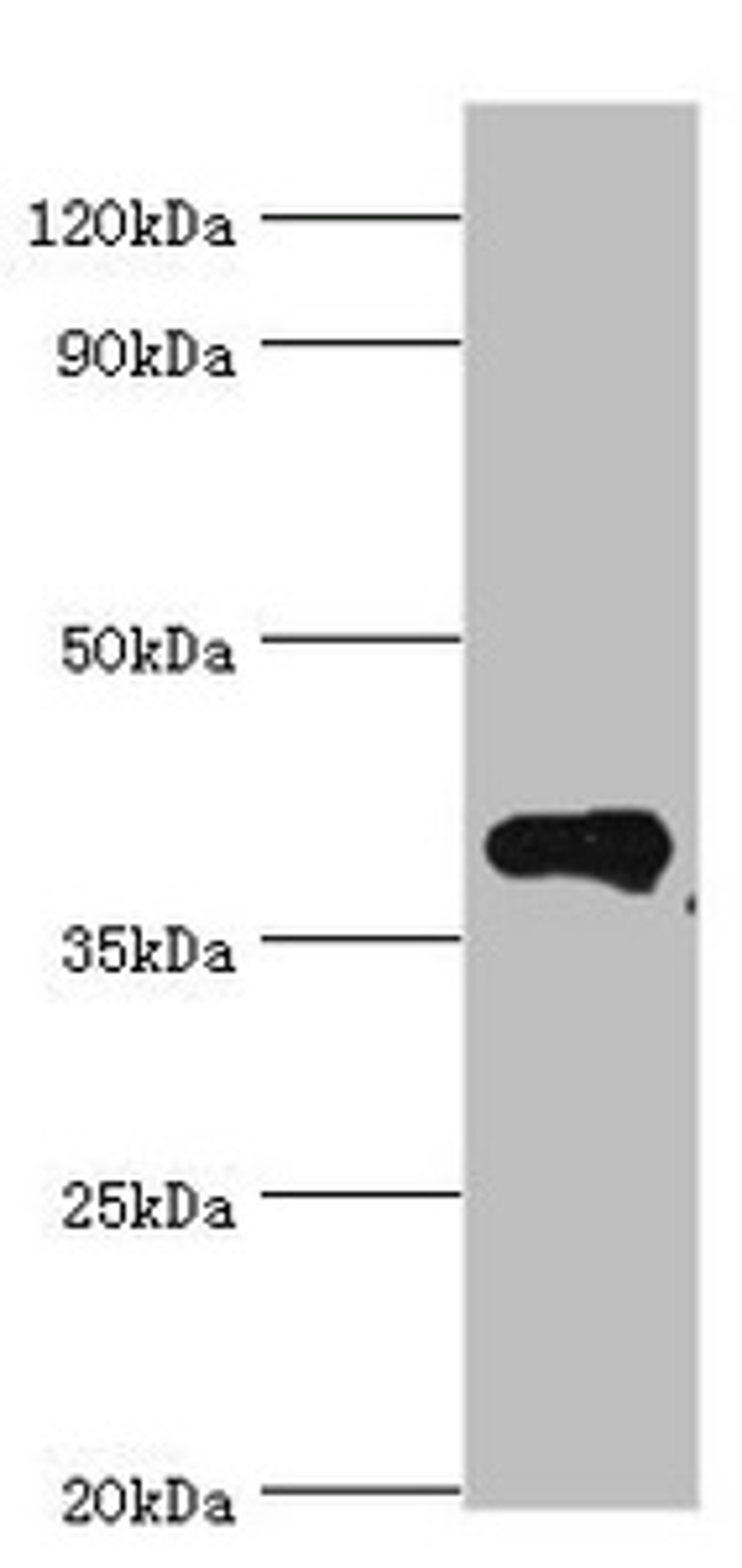 Western blot. All lanes: Phytanoyl-CoA dioxygenase, peroxisomal antibody at 4ug/ml + Mouse liver tissue. Secondary. Goat polyclonal to rabbit IgG at 1/10000 dilution. Predicted band size: 39, 28 kDa. Observed band size: 39 kDa.