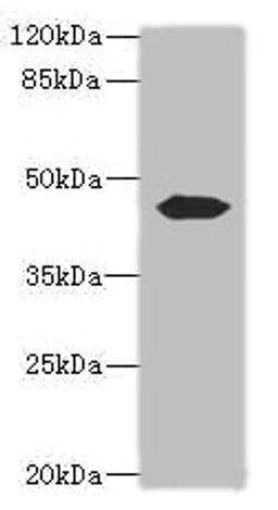 Western blot. All lanes: ACTL7B antibody at 0.2ug/ml + Mouse gonadal tissue. Secondary. Goat polyclonal to rabbit IgG at 1/10000 dilution. Predicted band size: 45 kDa. Observed band size: 45 kDa. 