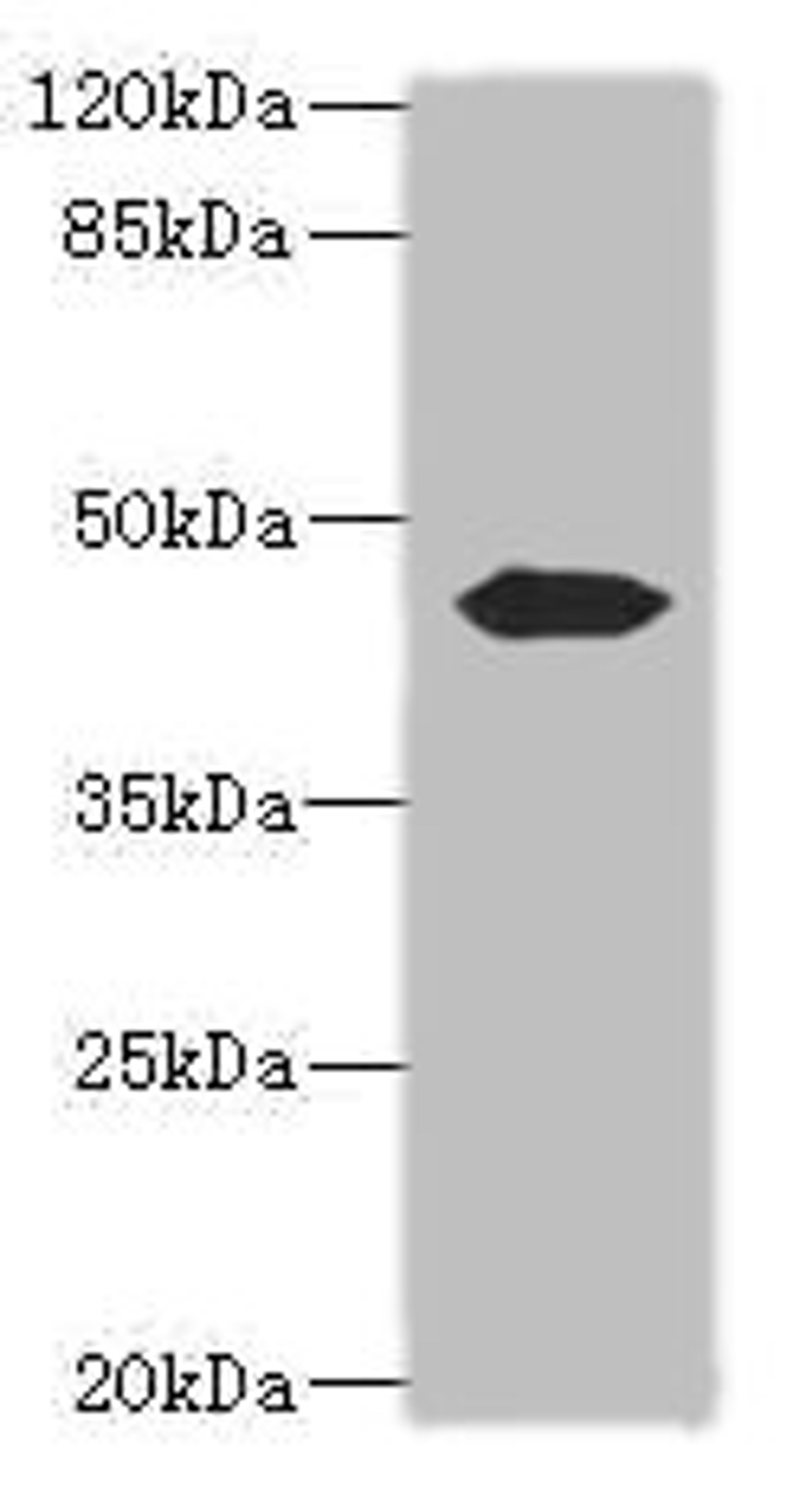 Western blot. All lanes: ACTL7B antibody at 0.2ug/ml + Mouse gonadal tissue. Secondary. Goat polyclonal to rabbit IgG at 1/10000 dilution. Predicted band size: 45 kDa. Observed band size: 45 kDa. 